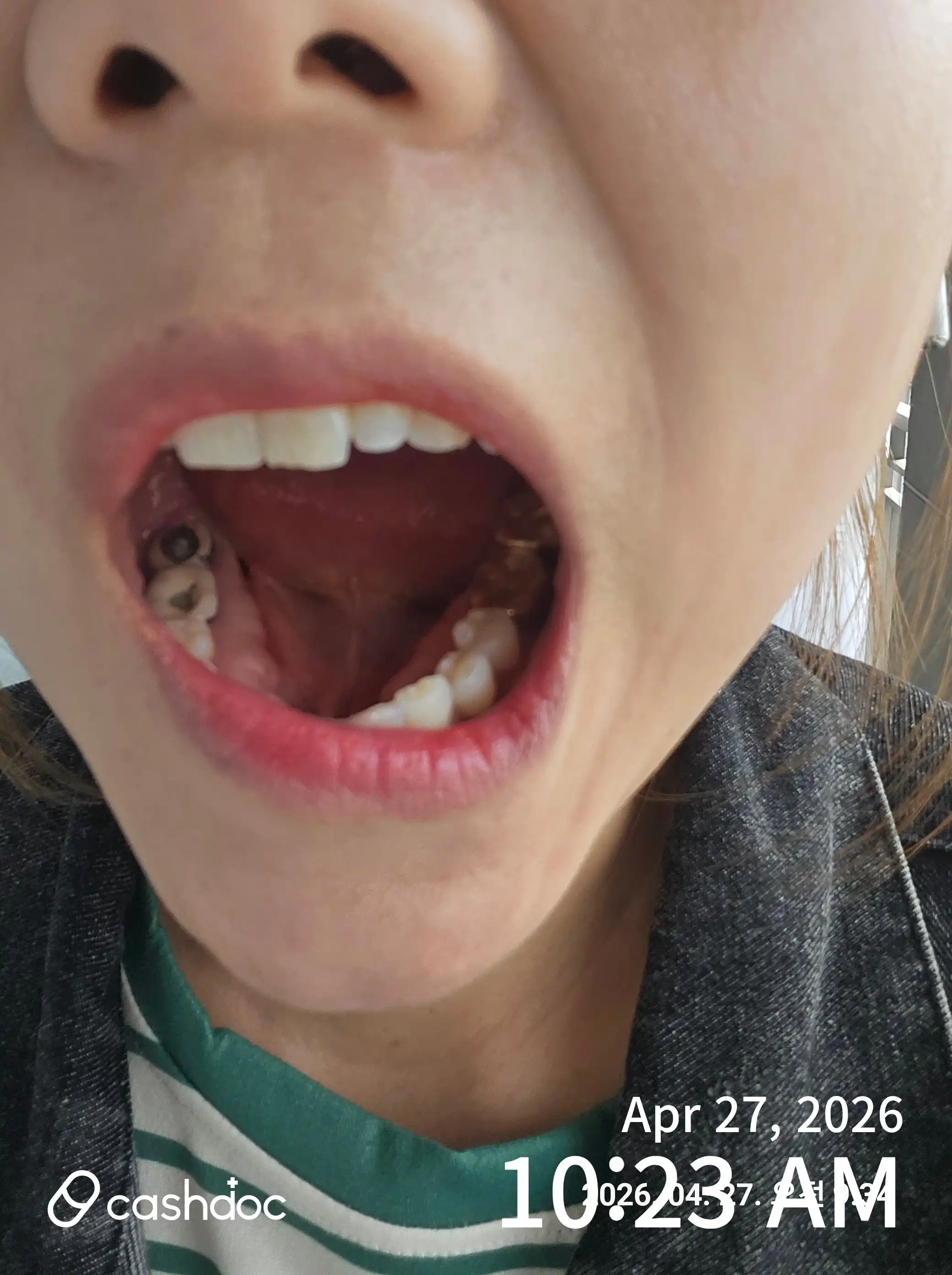 Review photo