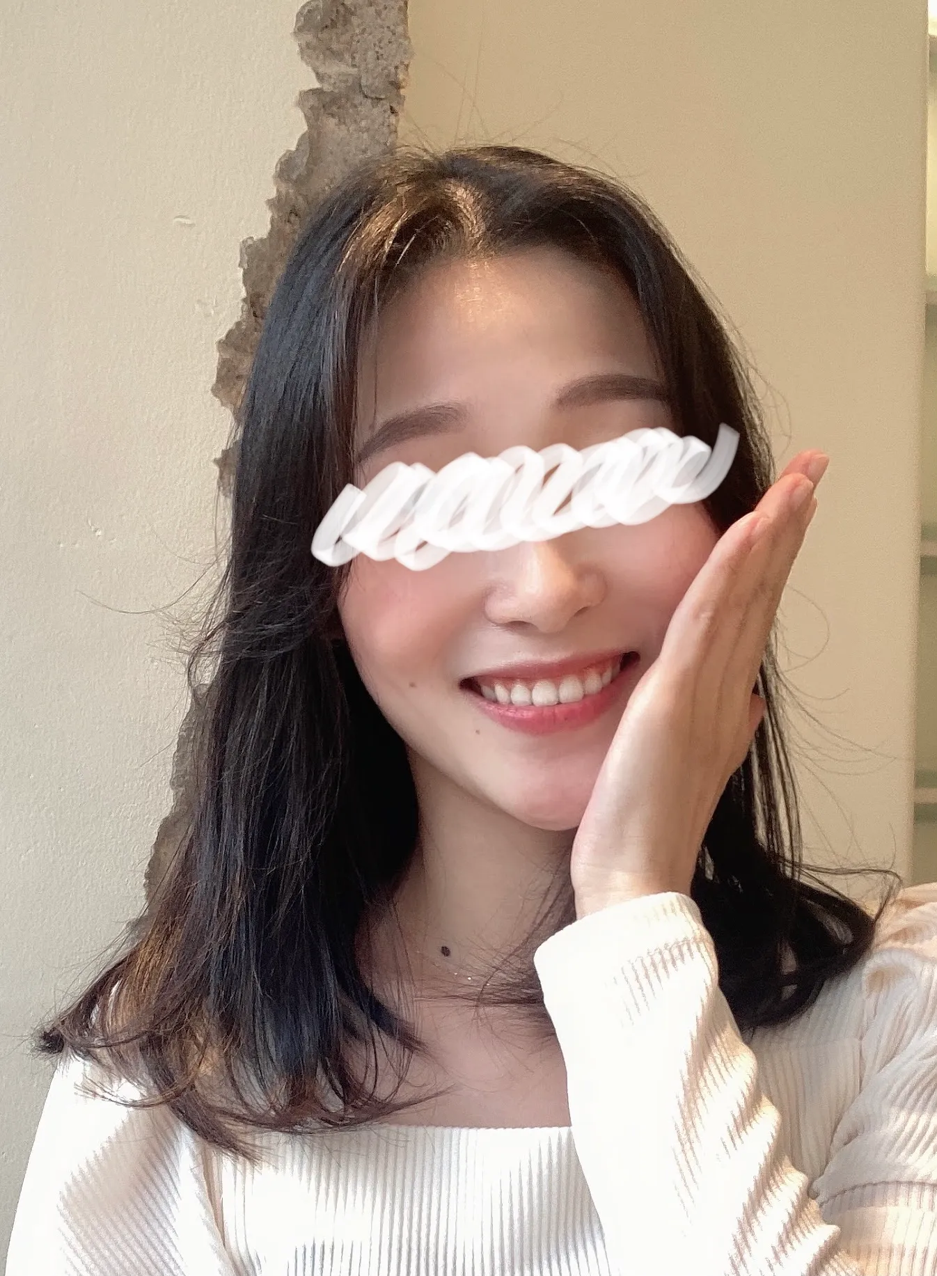 시술 전 — 윤곽주사,비스테로이드 GPC주사