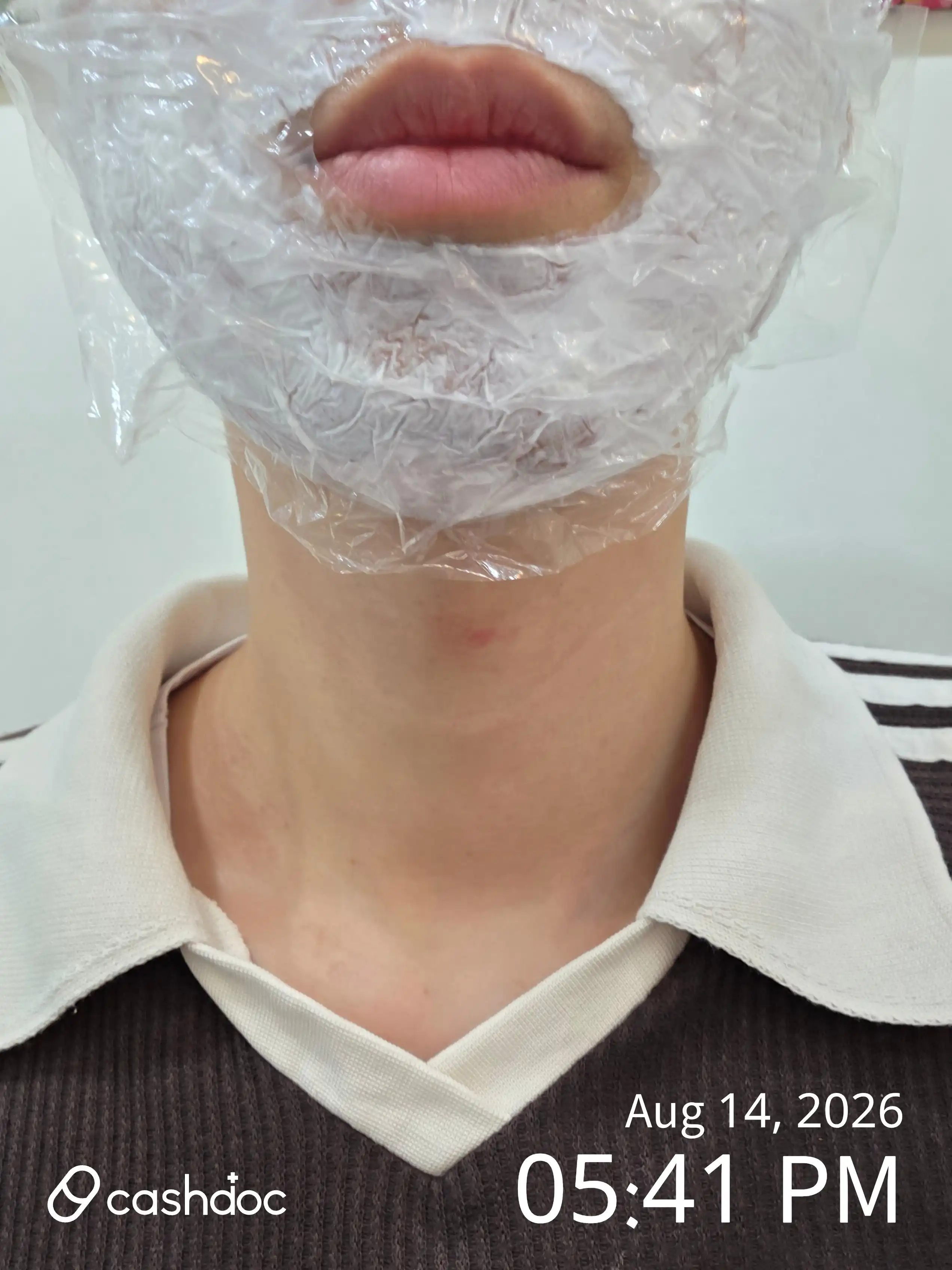 Review photo