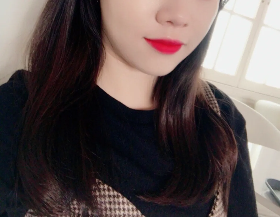 시술 전 — 튀어나온 턱라인 정리. 침샘보톡스