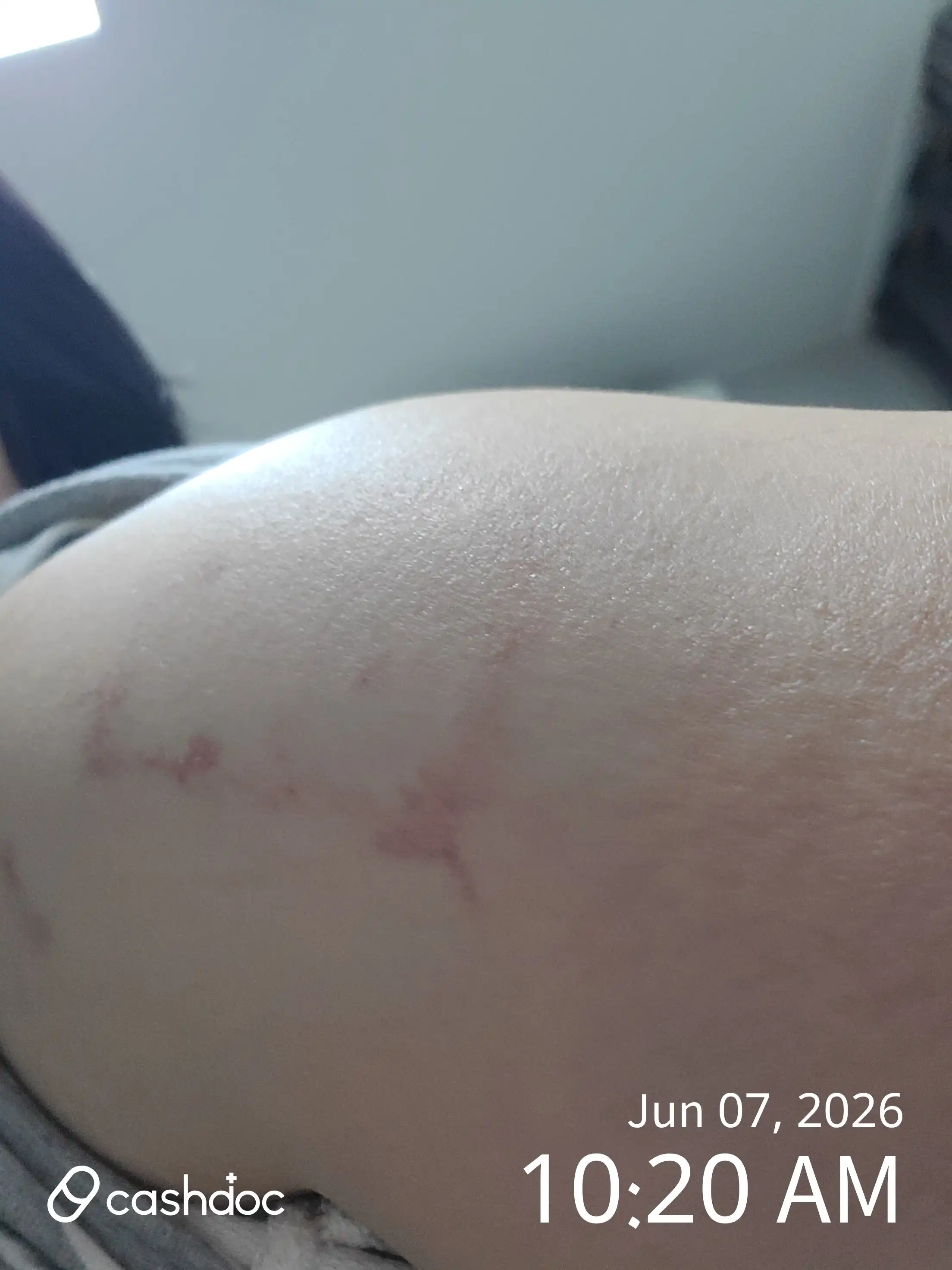 Review photo