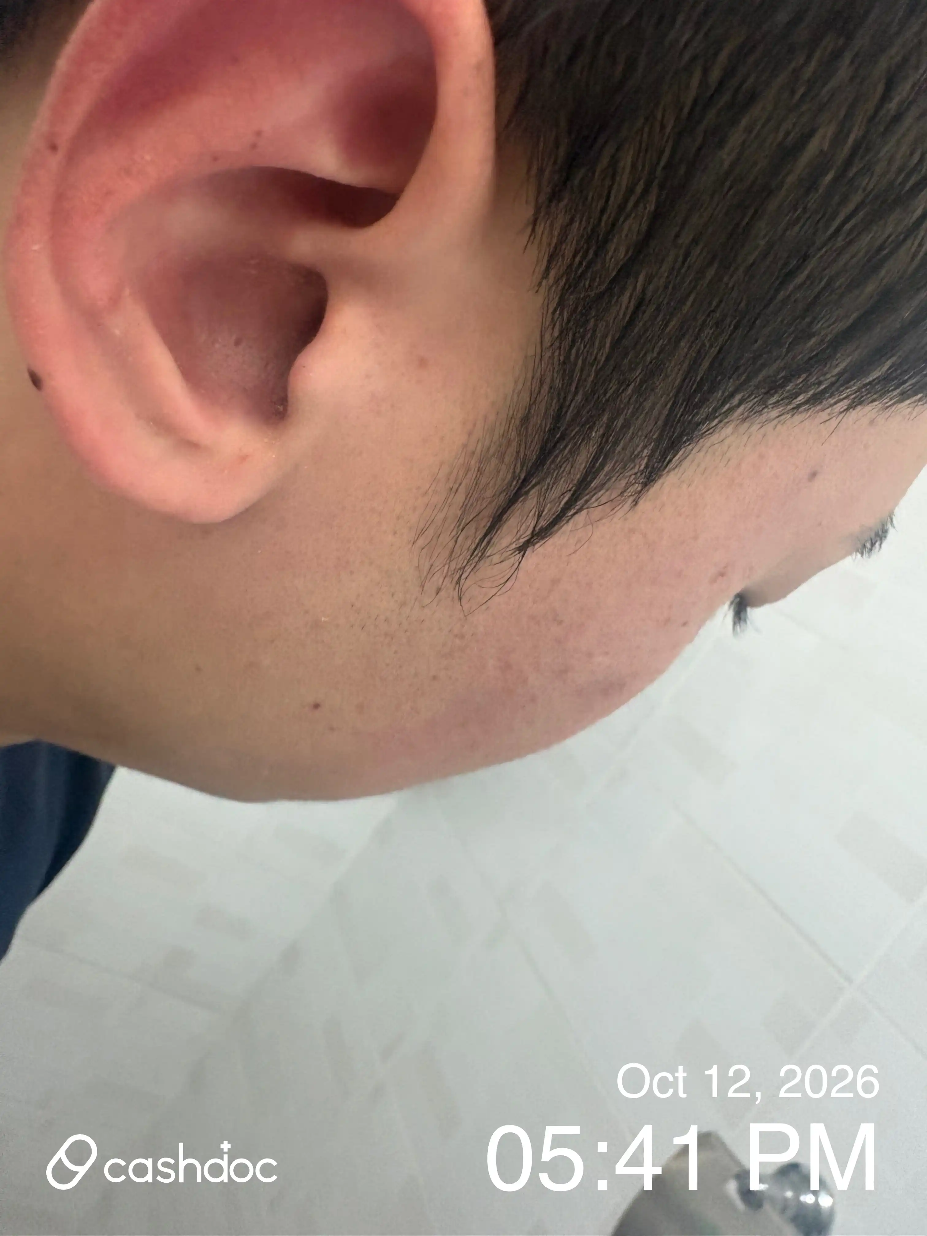 Review photo
