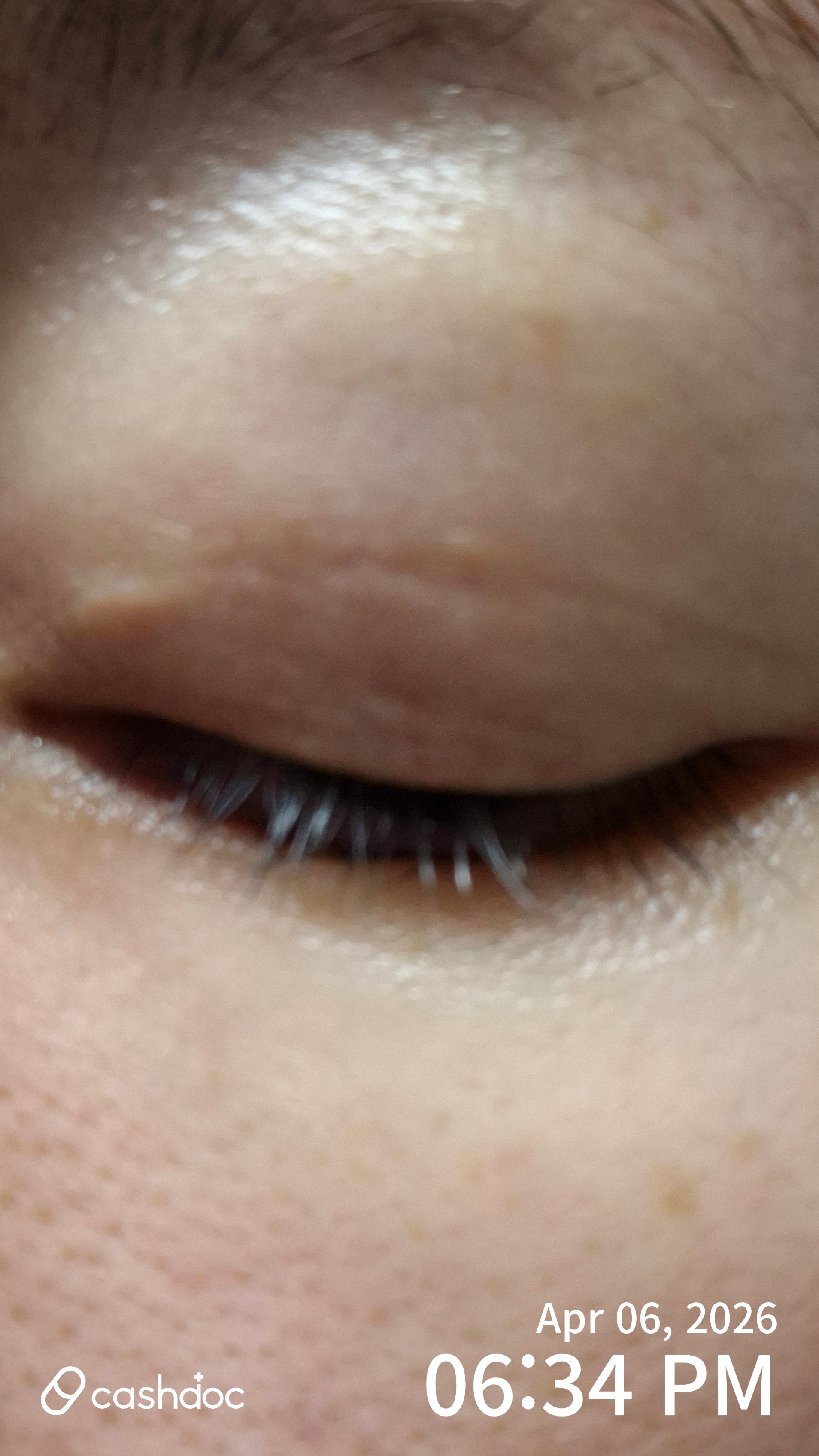 남양주시 은하수안과의원에서 정확하고 친절한 진료 경험!