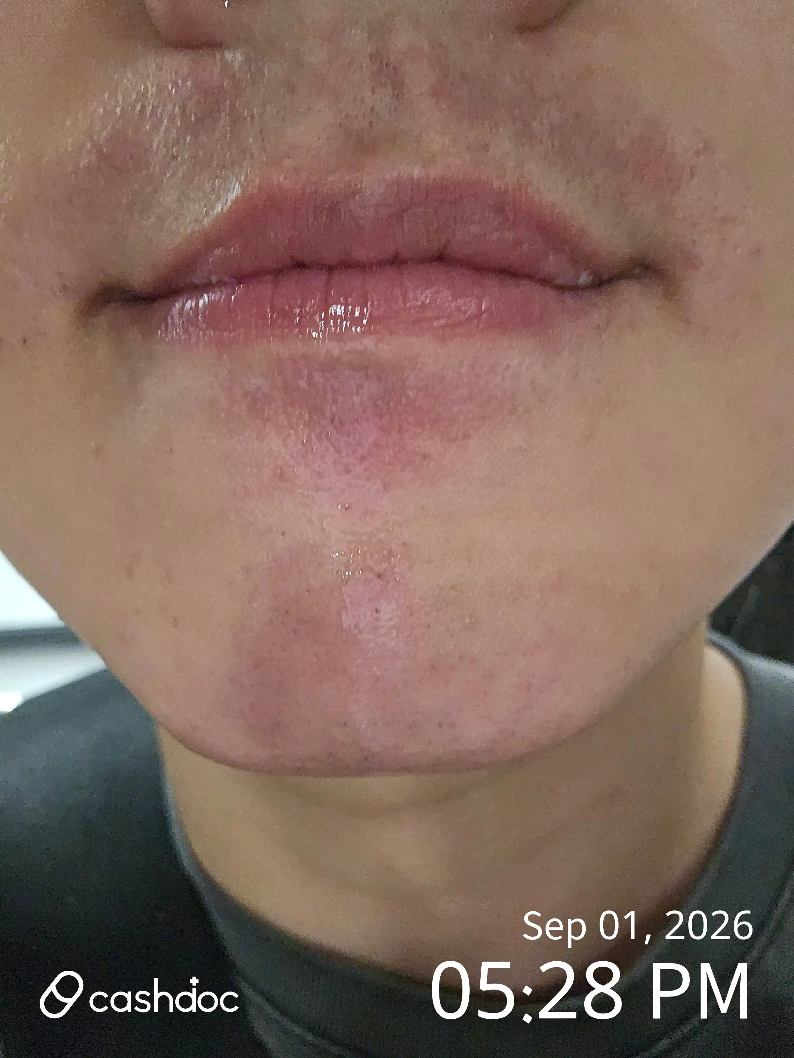 评价照片