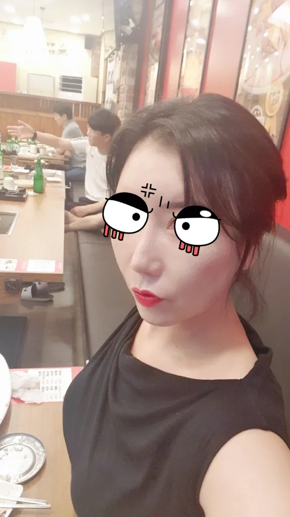 시술 전 — 헐리웃리프팅 #인모드 