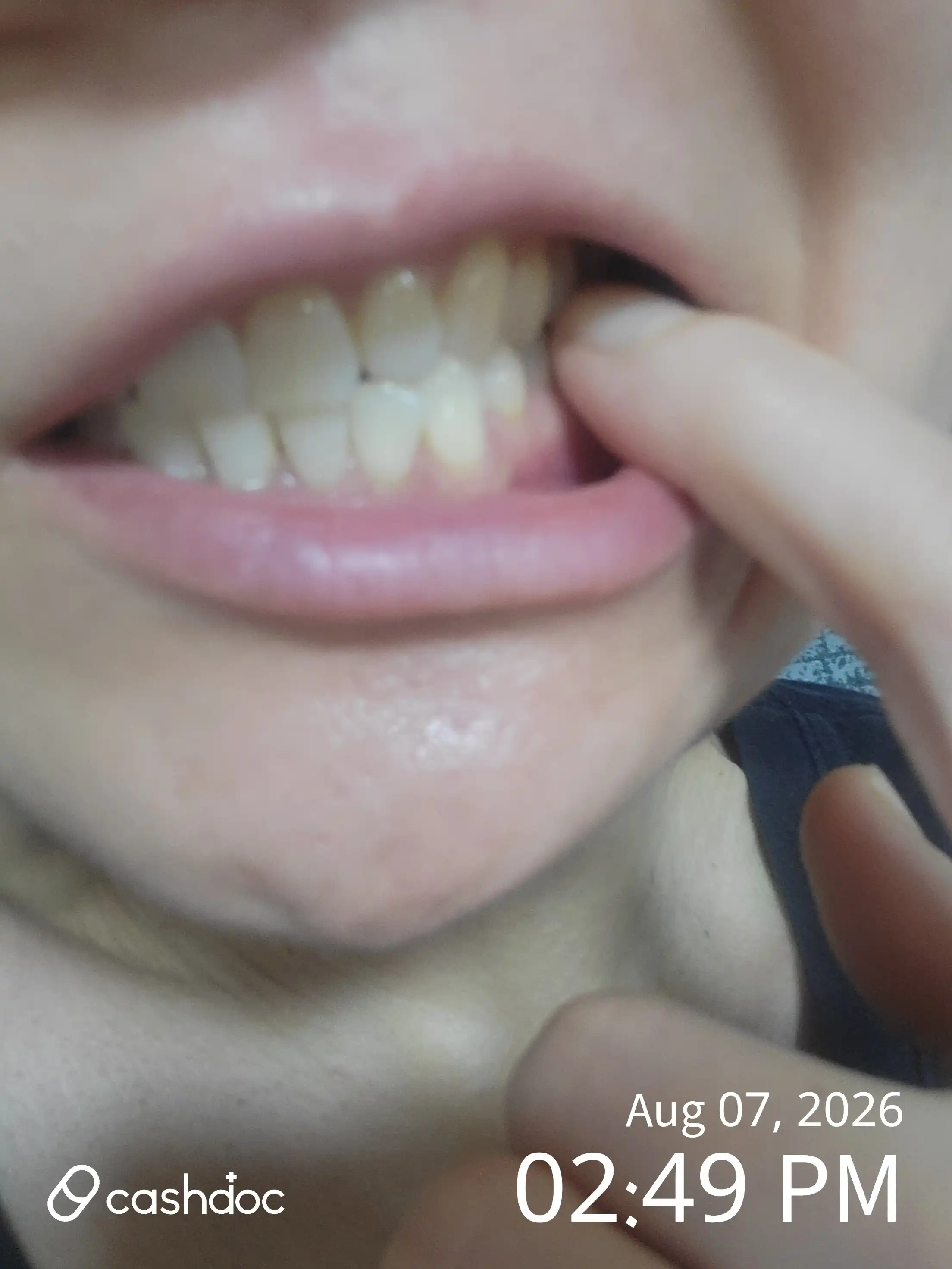 Review photo