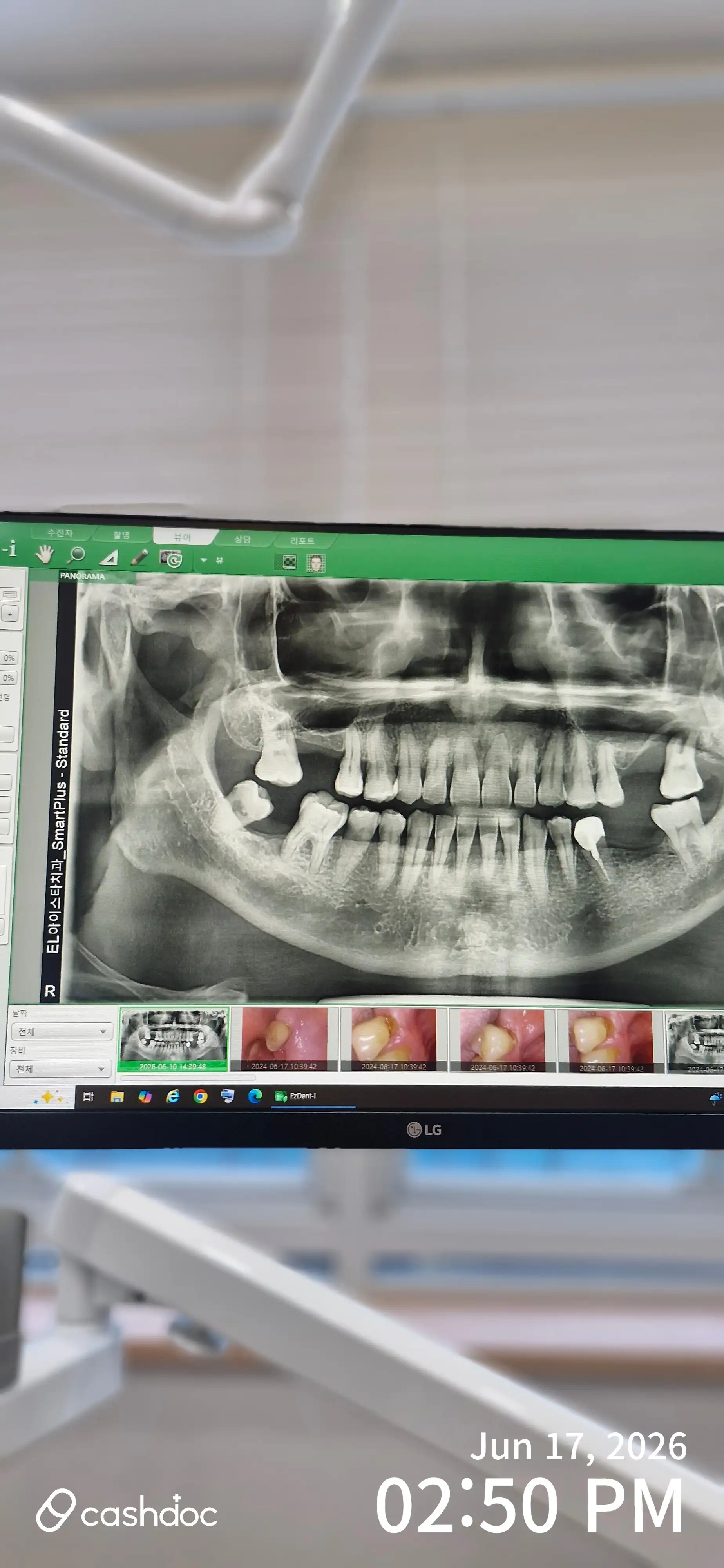 Review photo