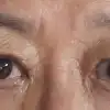 後