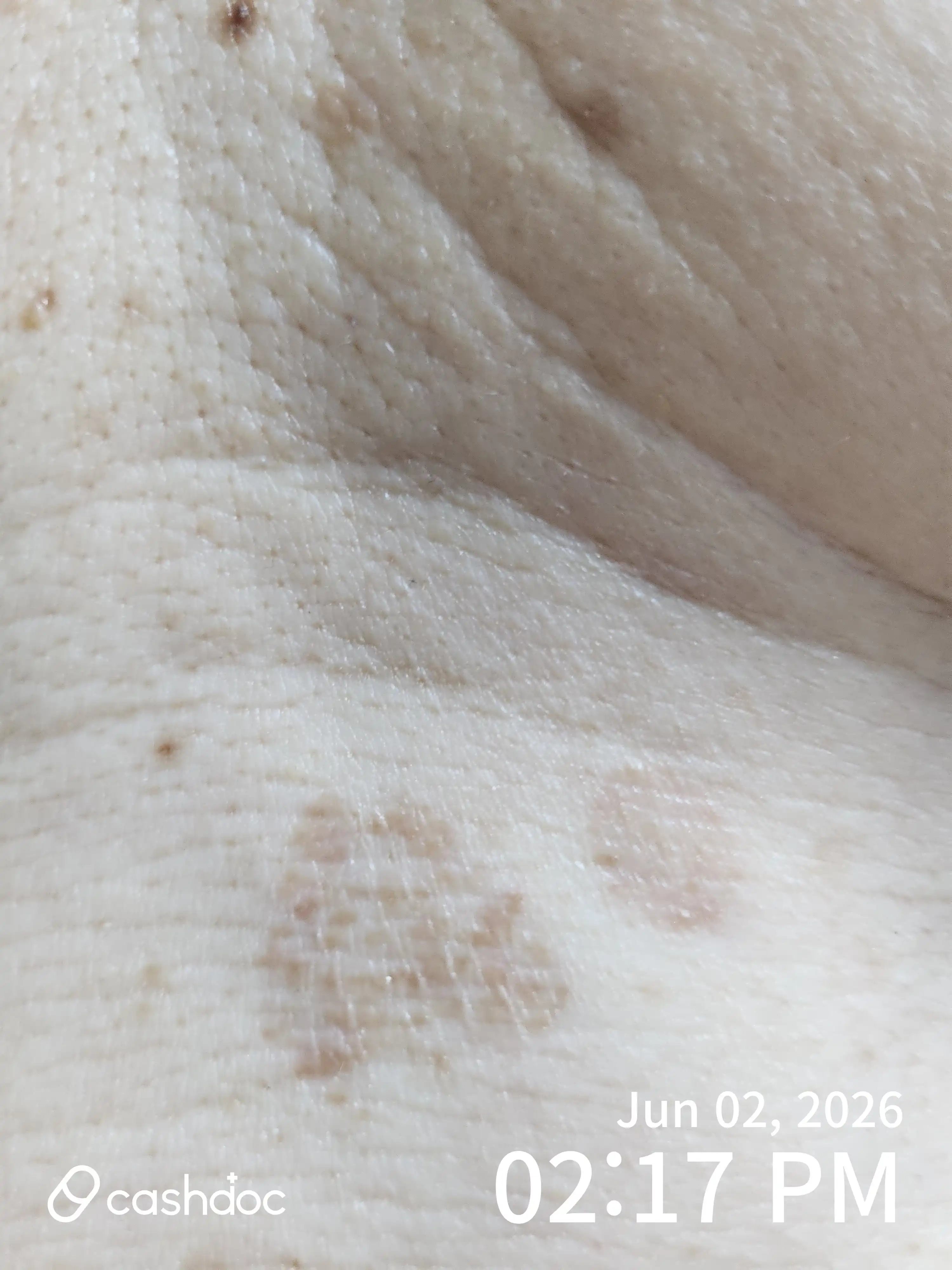 Review photo