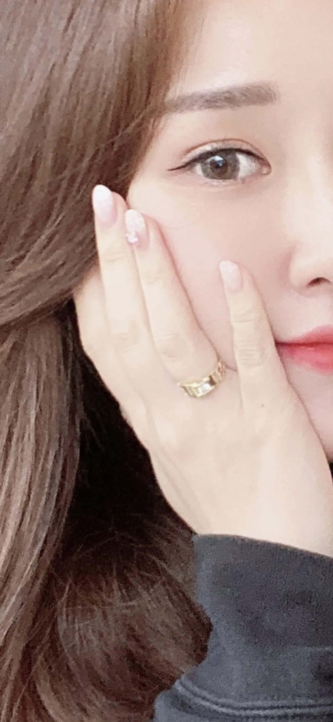 시술 전 — 싸이토케어 (에르메스주사)