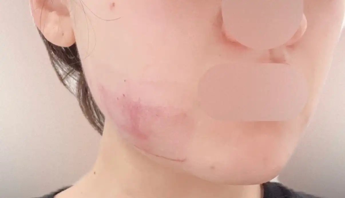 评价照片