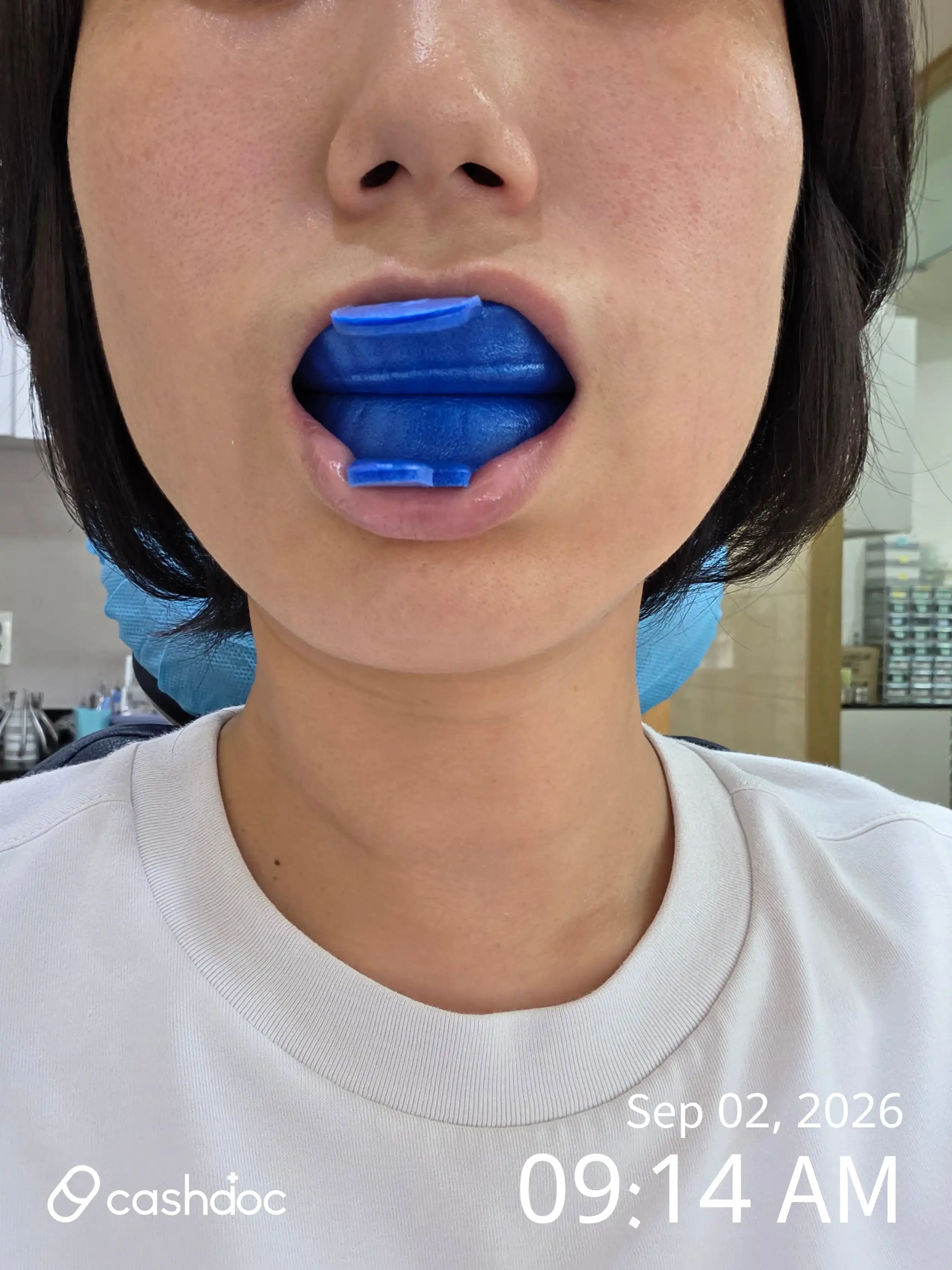 리뷰 사진