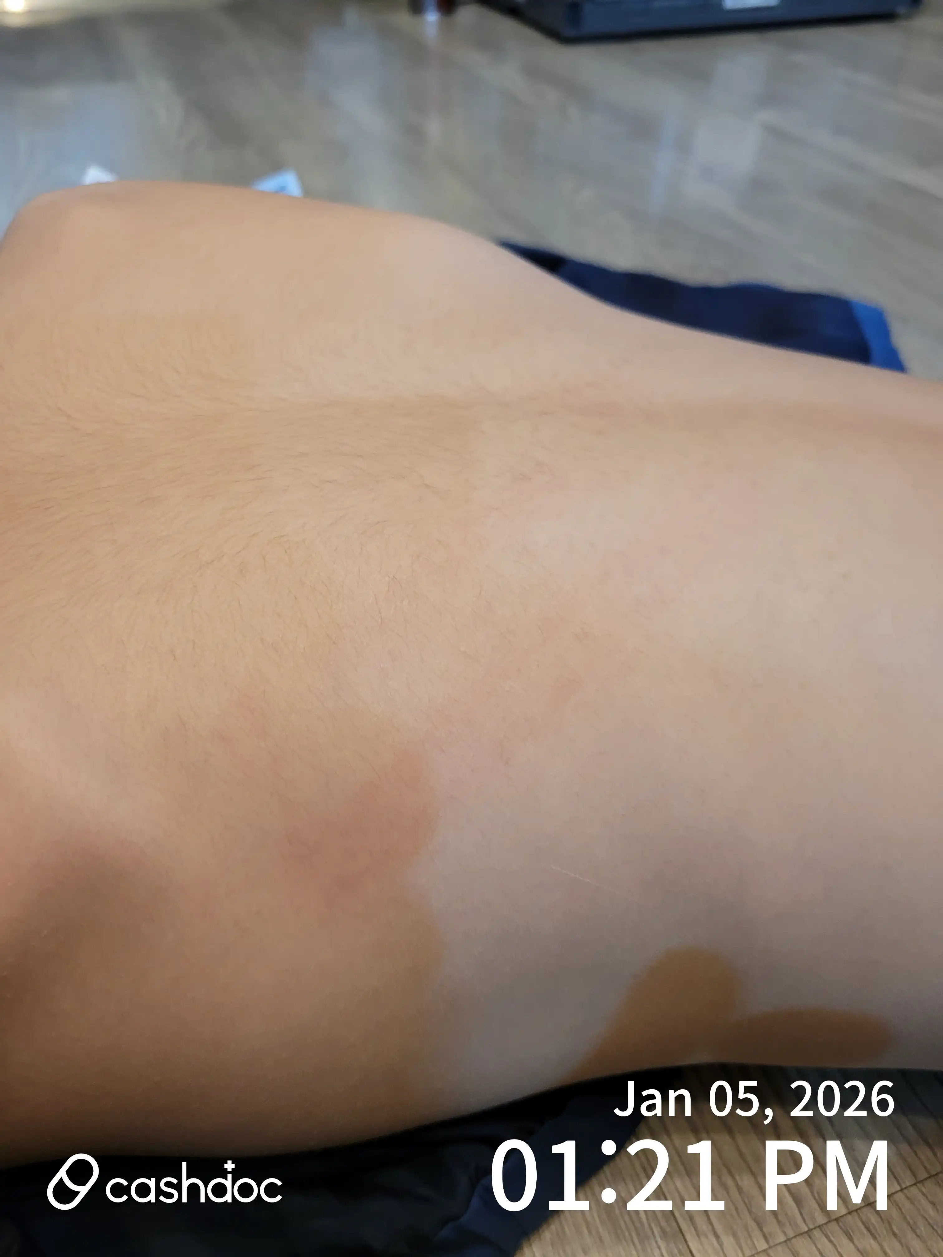 Review photo