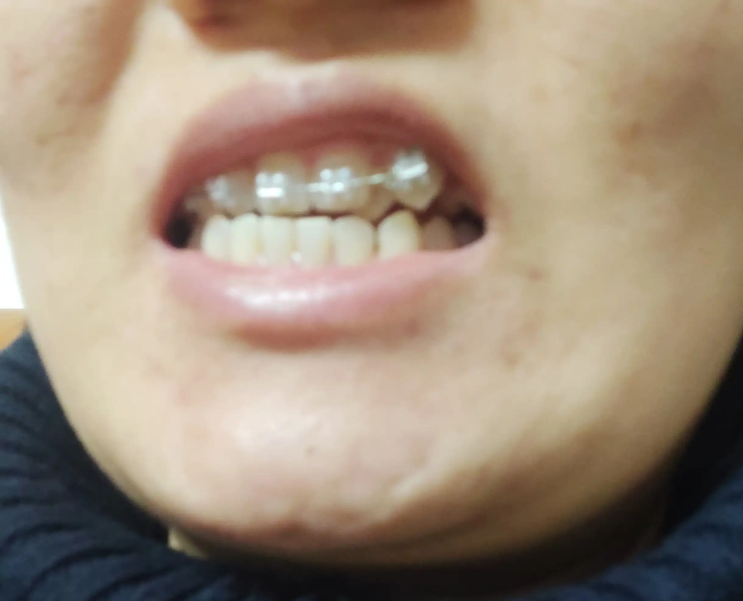 전