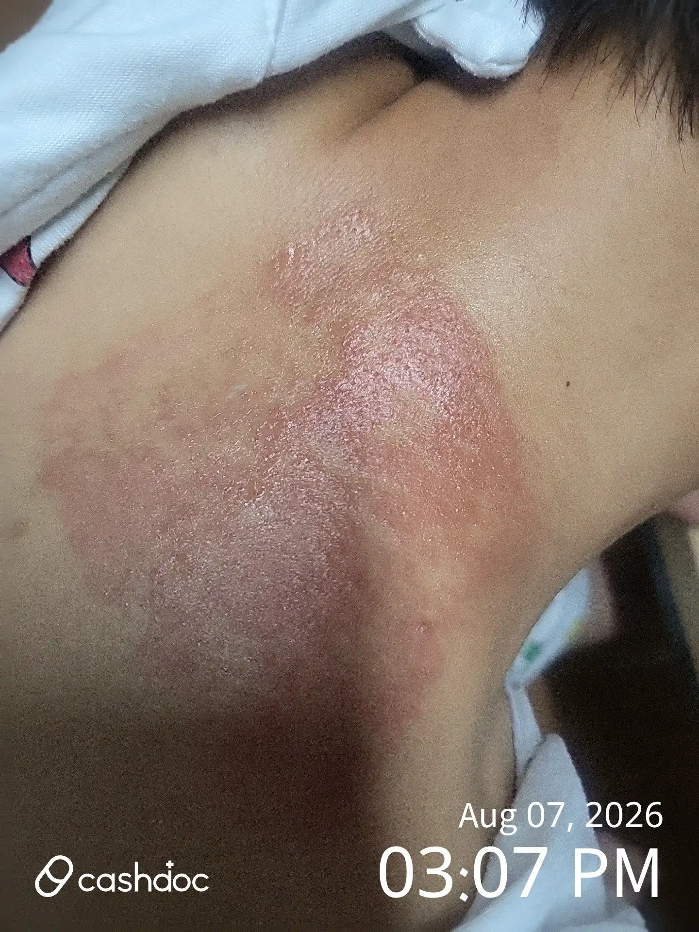 리뷰 사진
