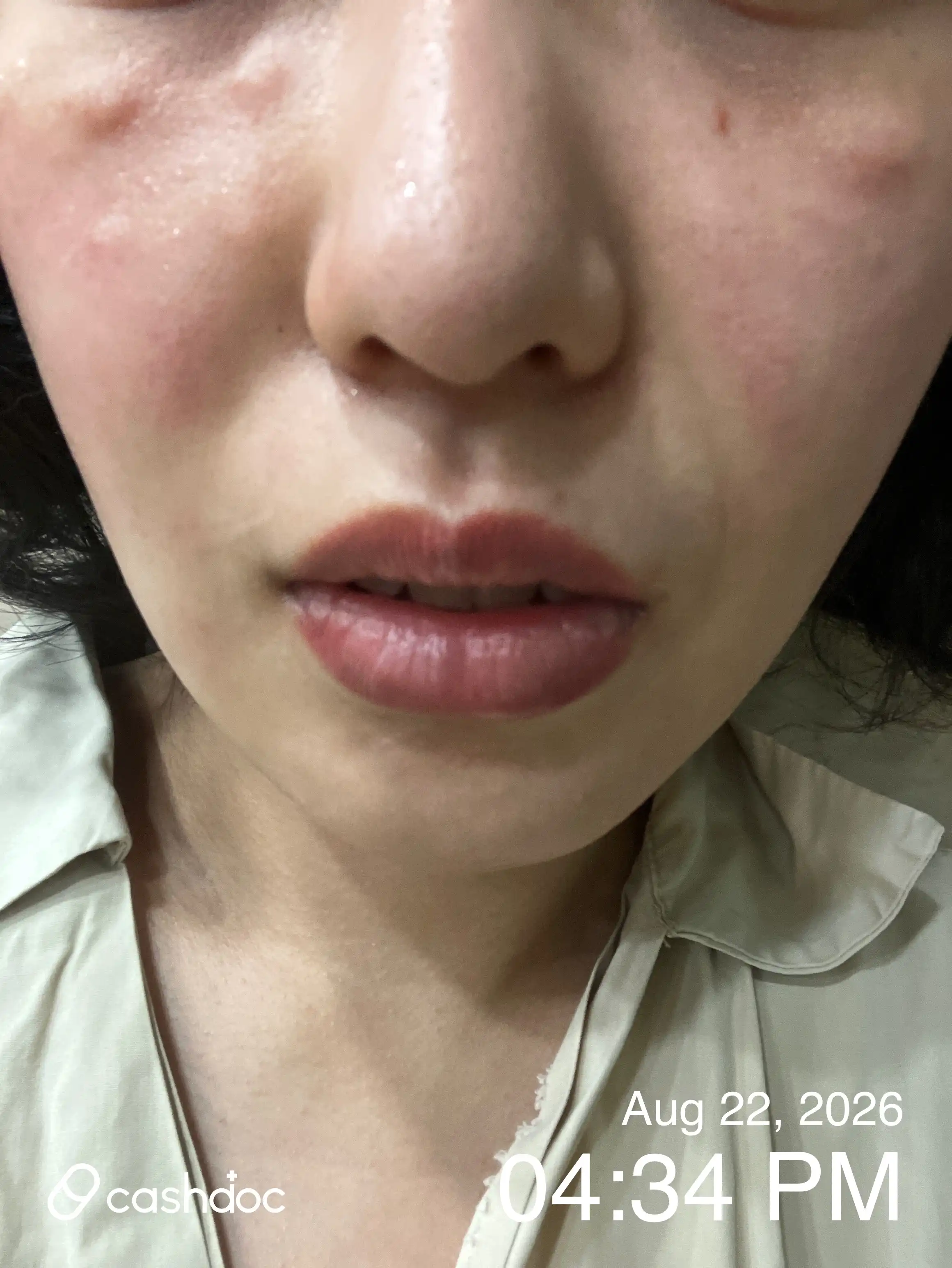 评价照片