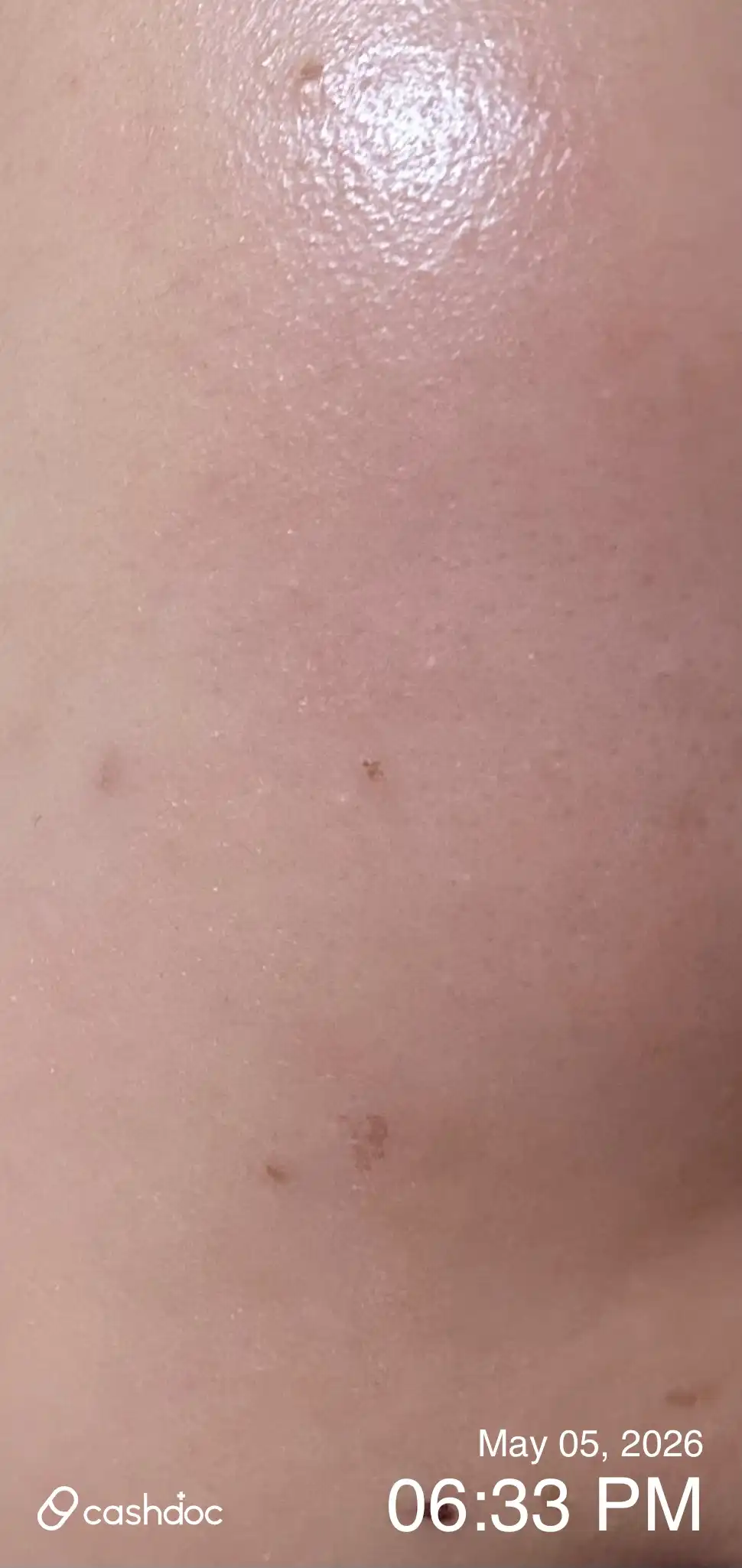 Review photo