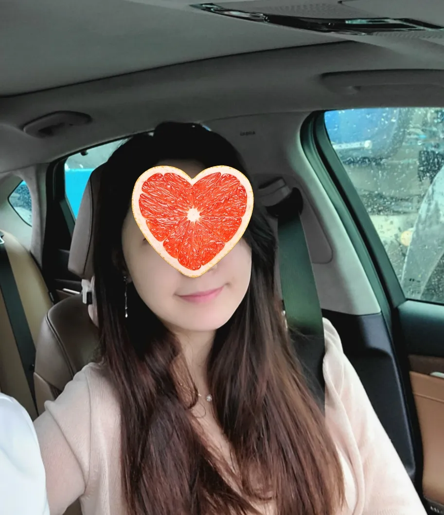 시술 전 — 올리지오+인모드❤9.9만