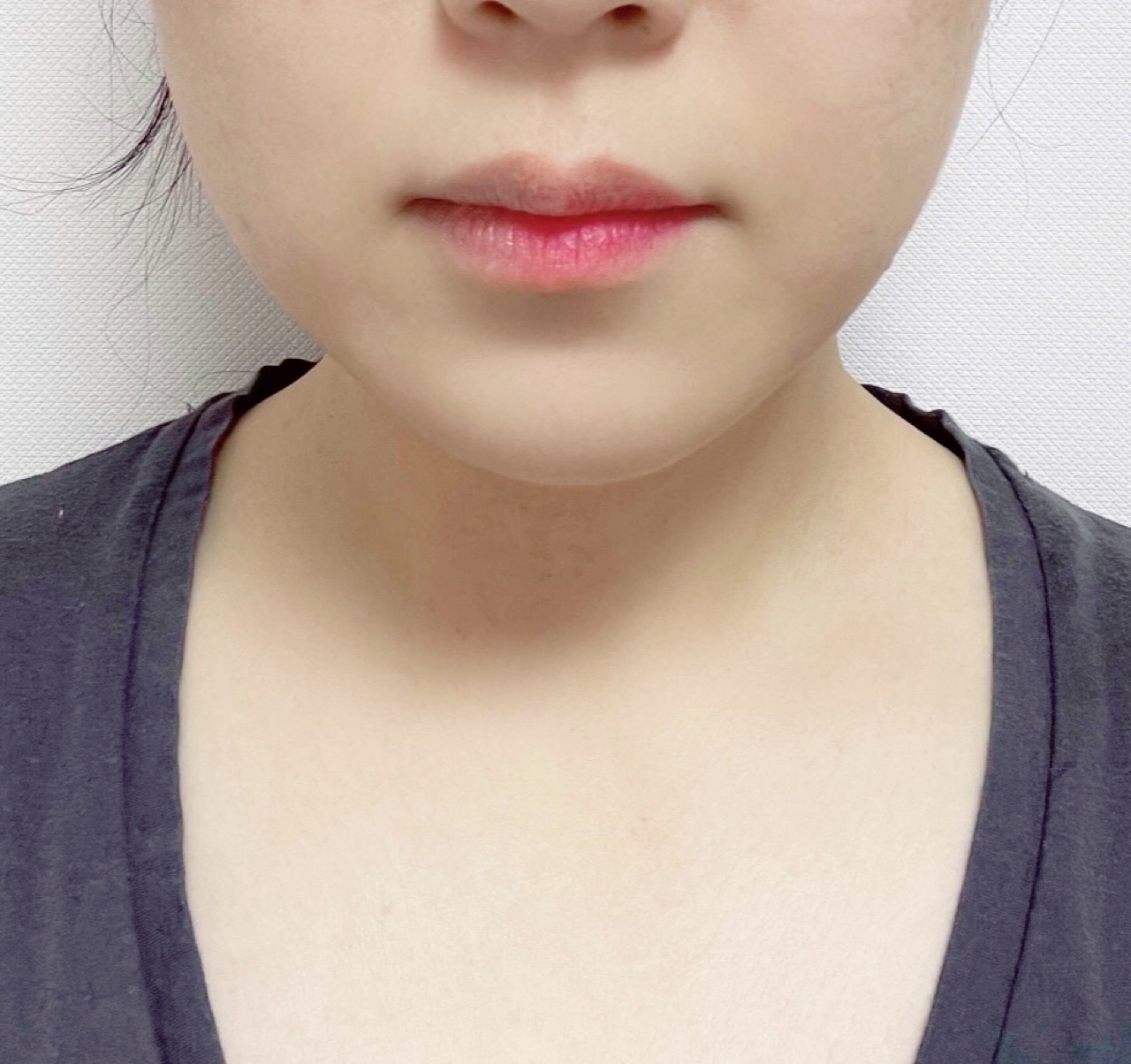 後