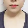 後