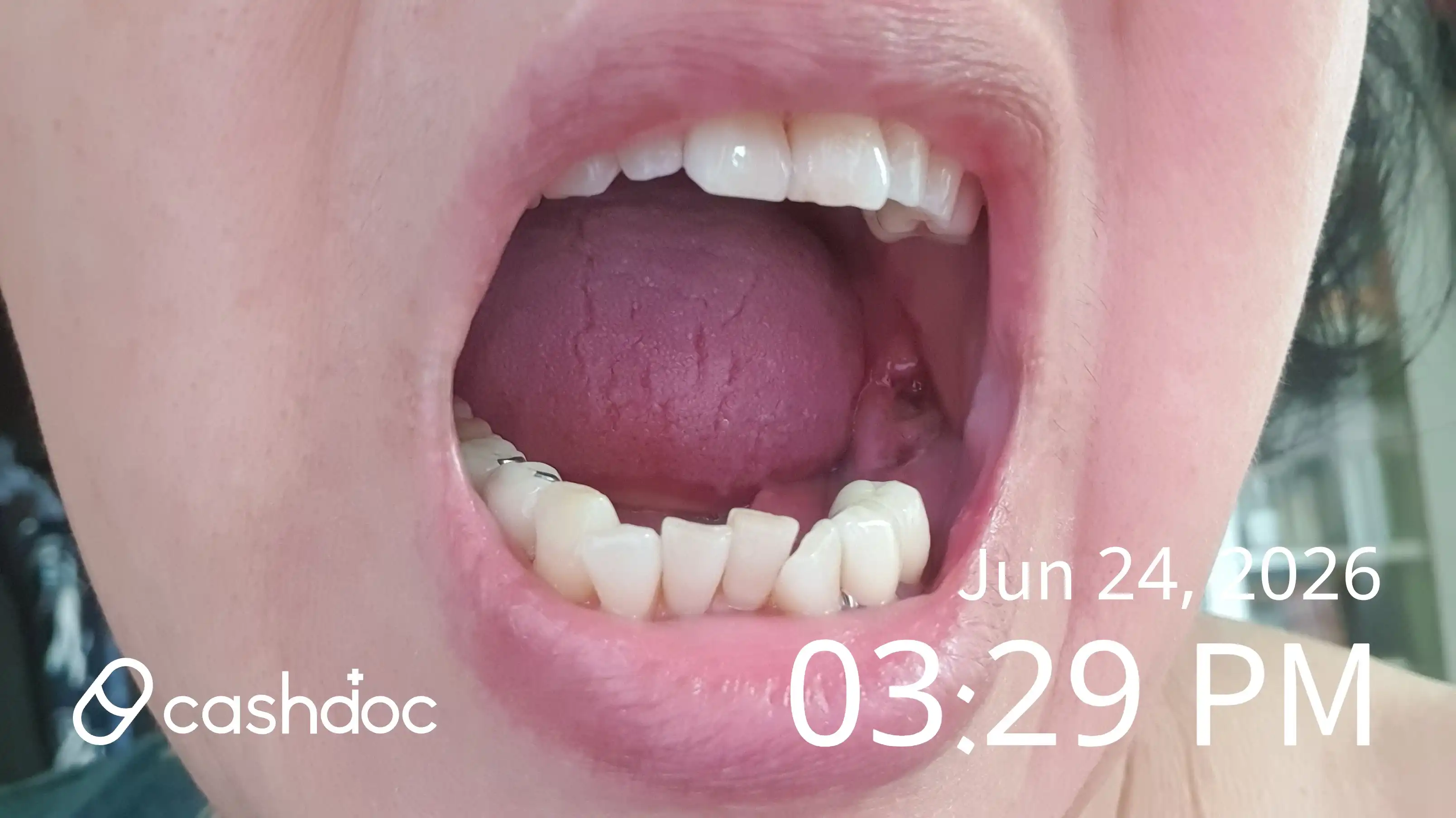 Review photo