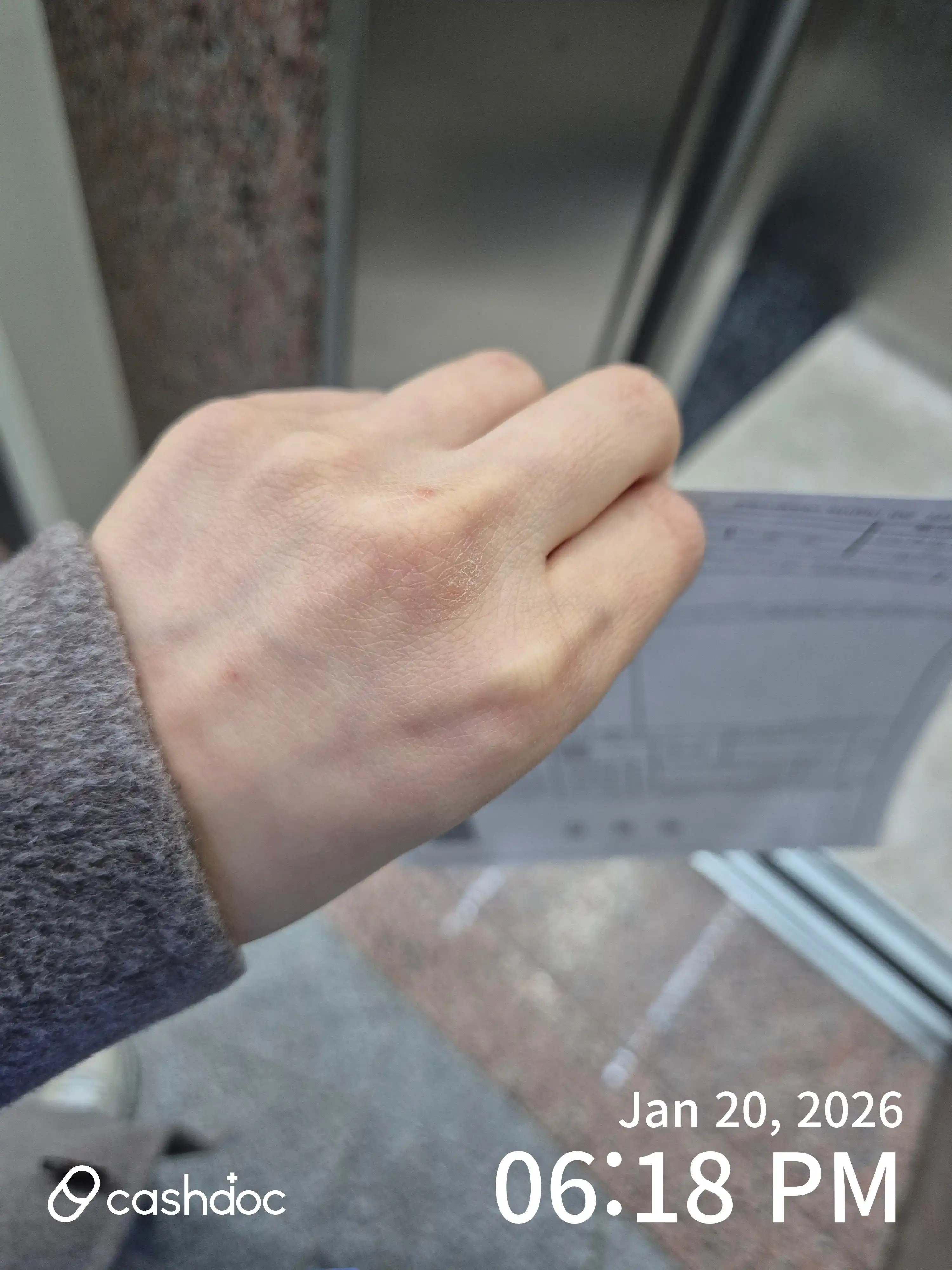 Review photo