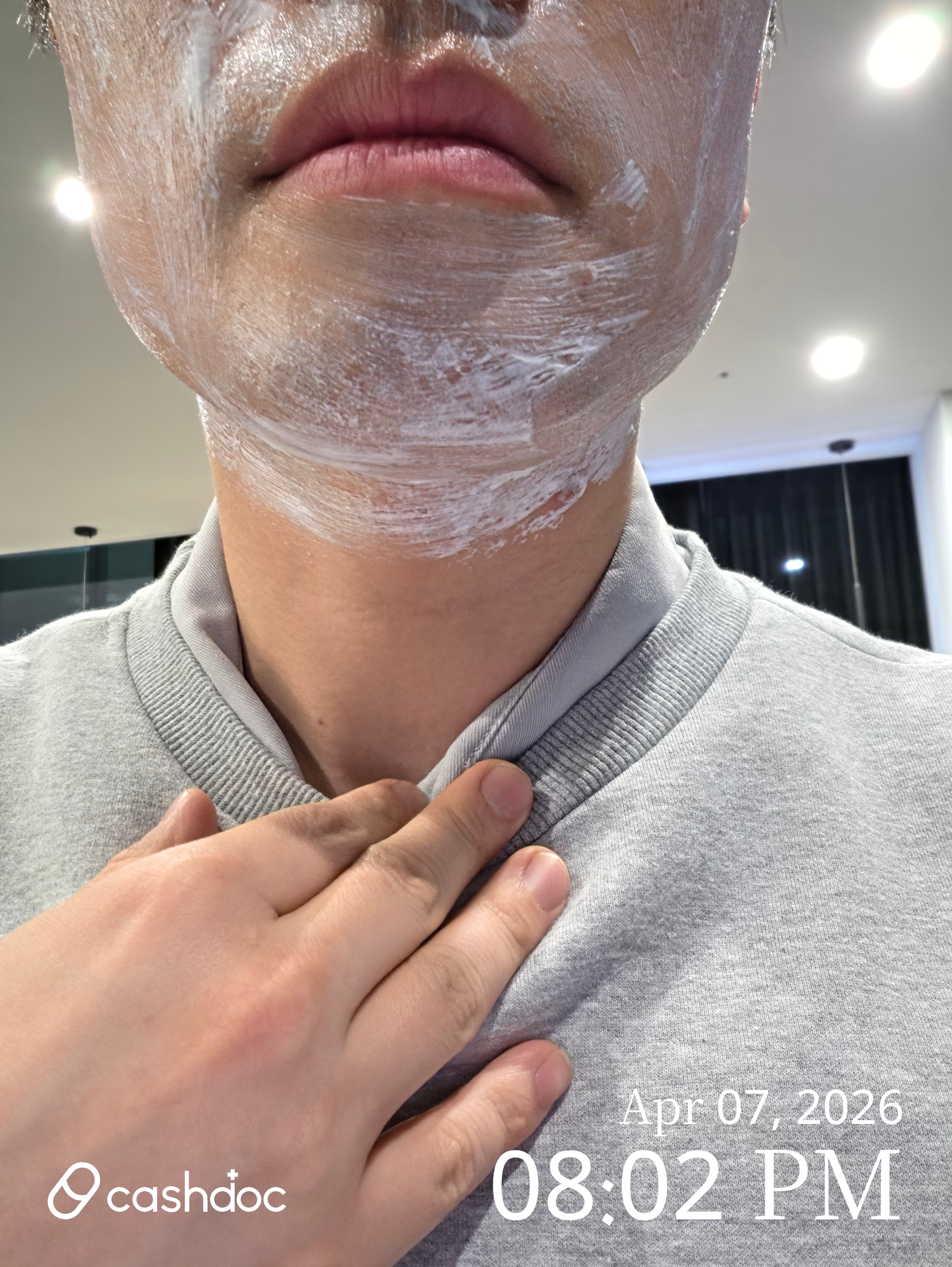 서초구 메티의원 레이저 제모, 통증 적고 만족스러워