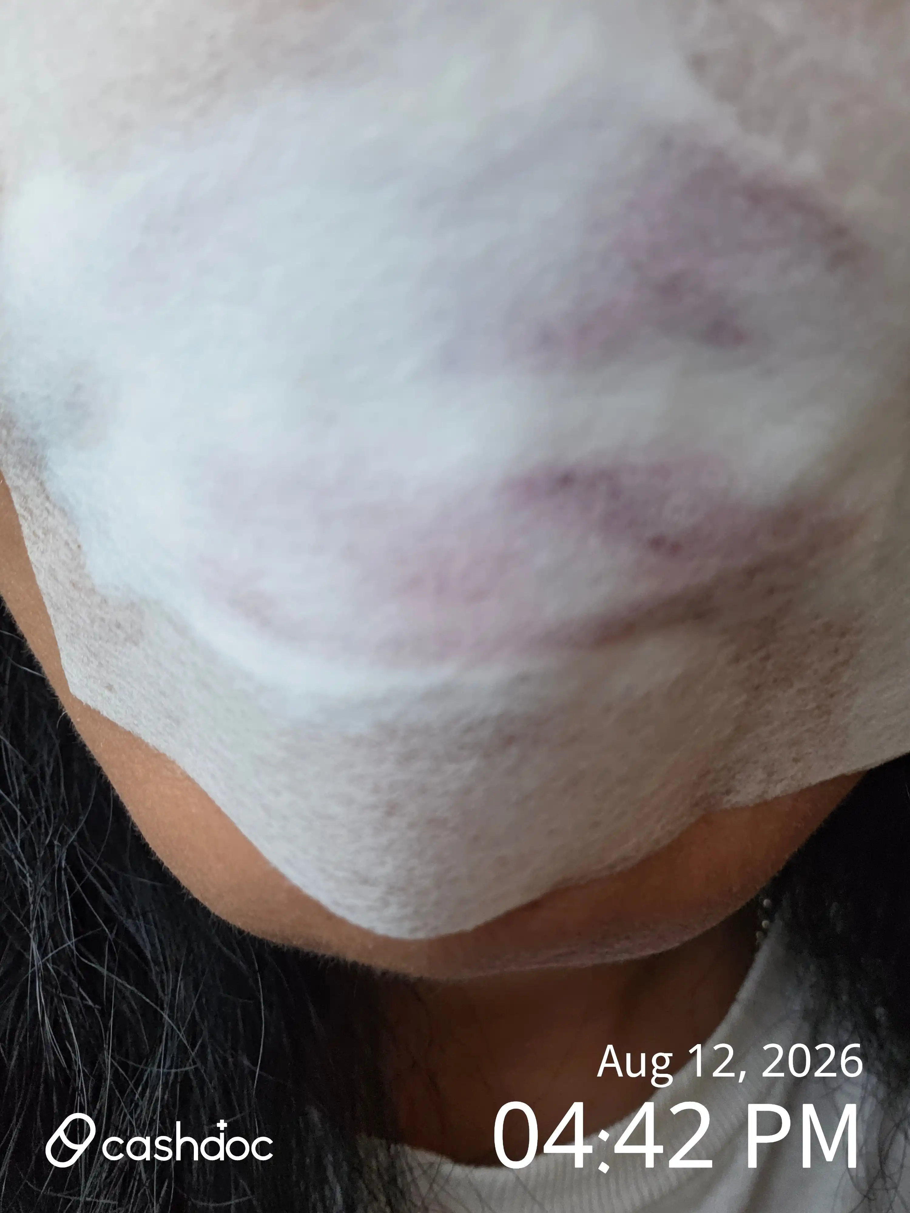 评价照片