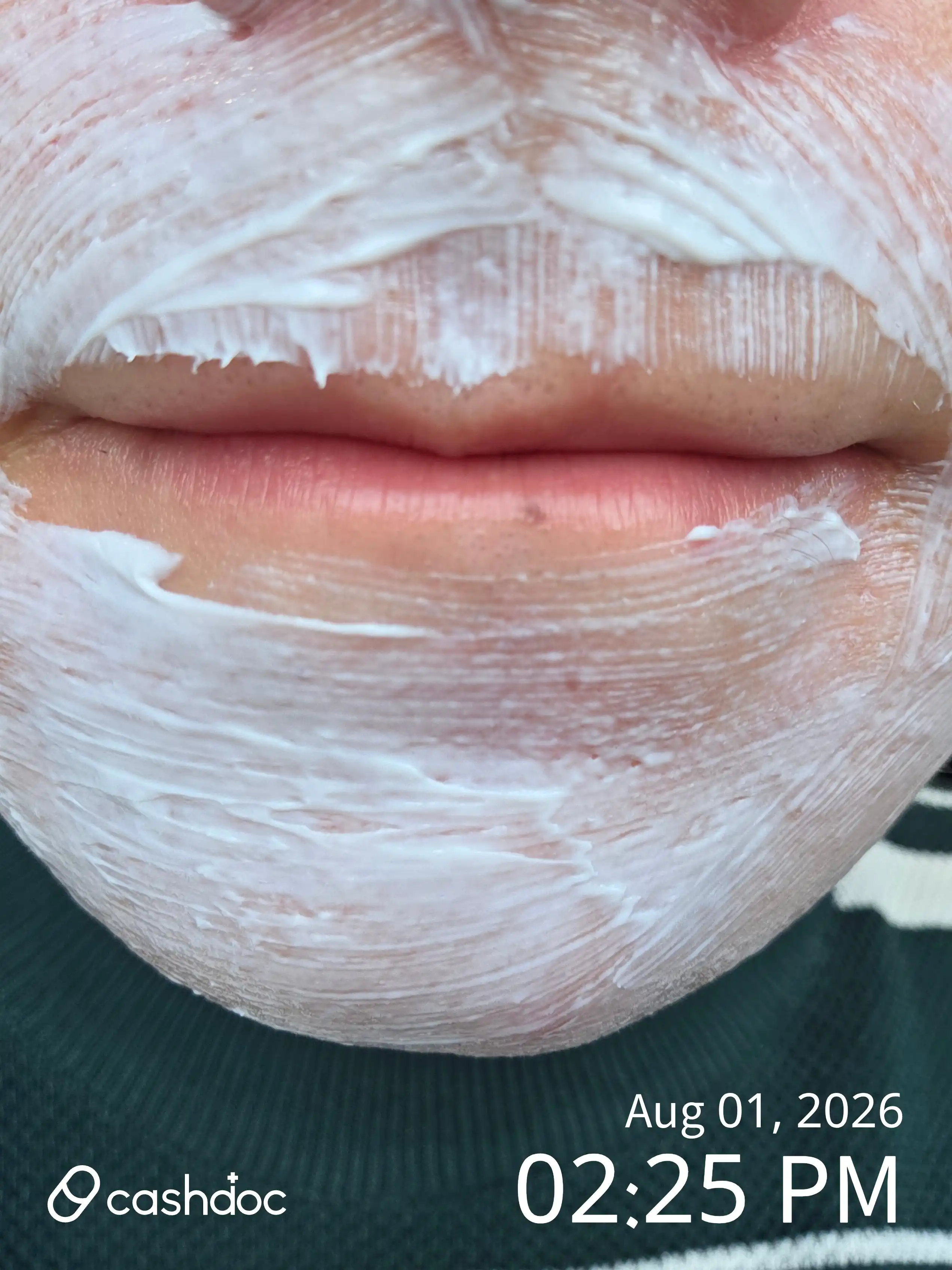 Review photo