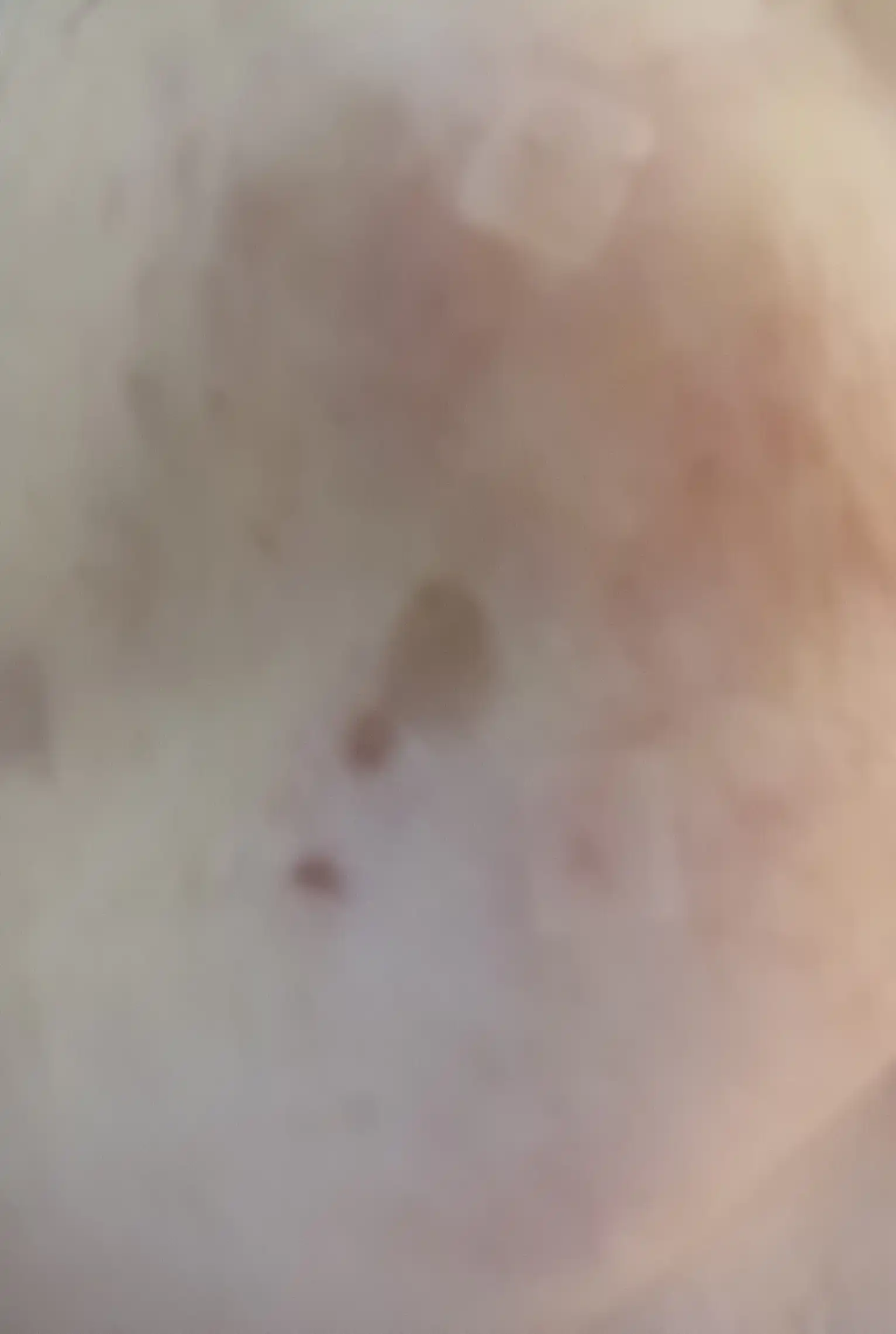 전