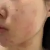 前