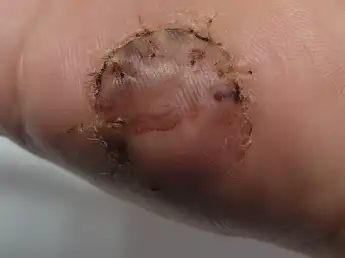 评价照片