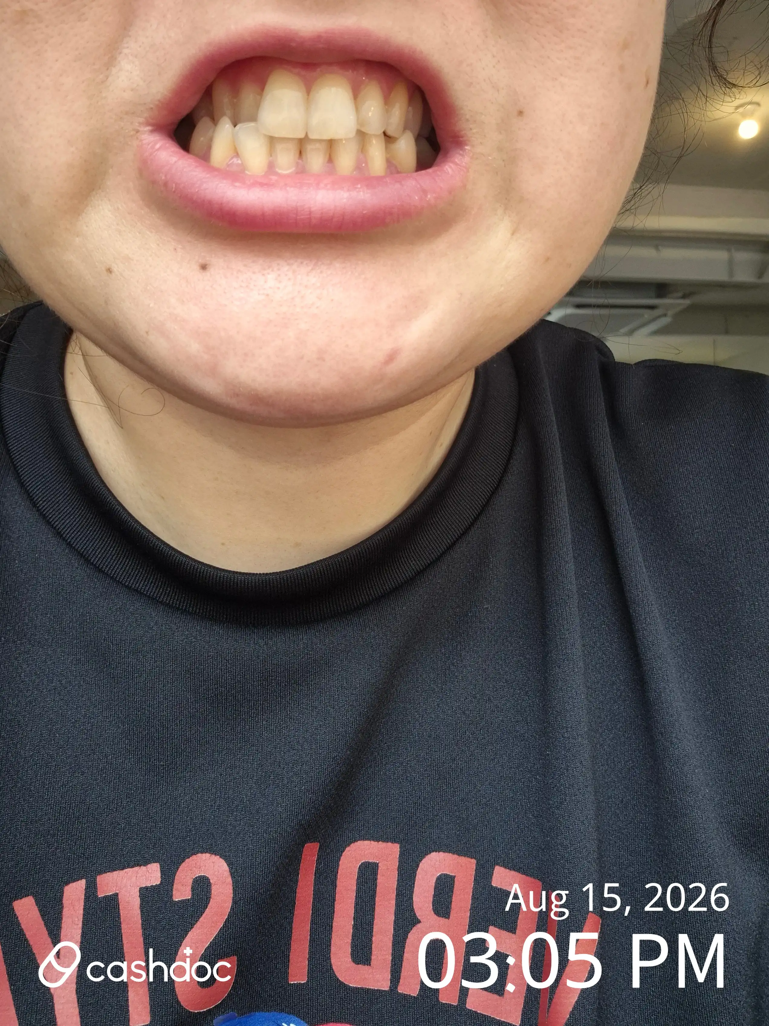 Review photo
