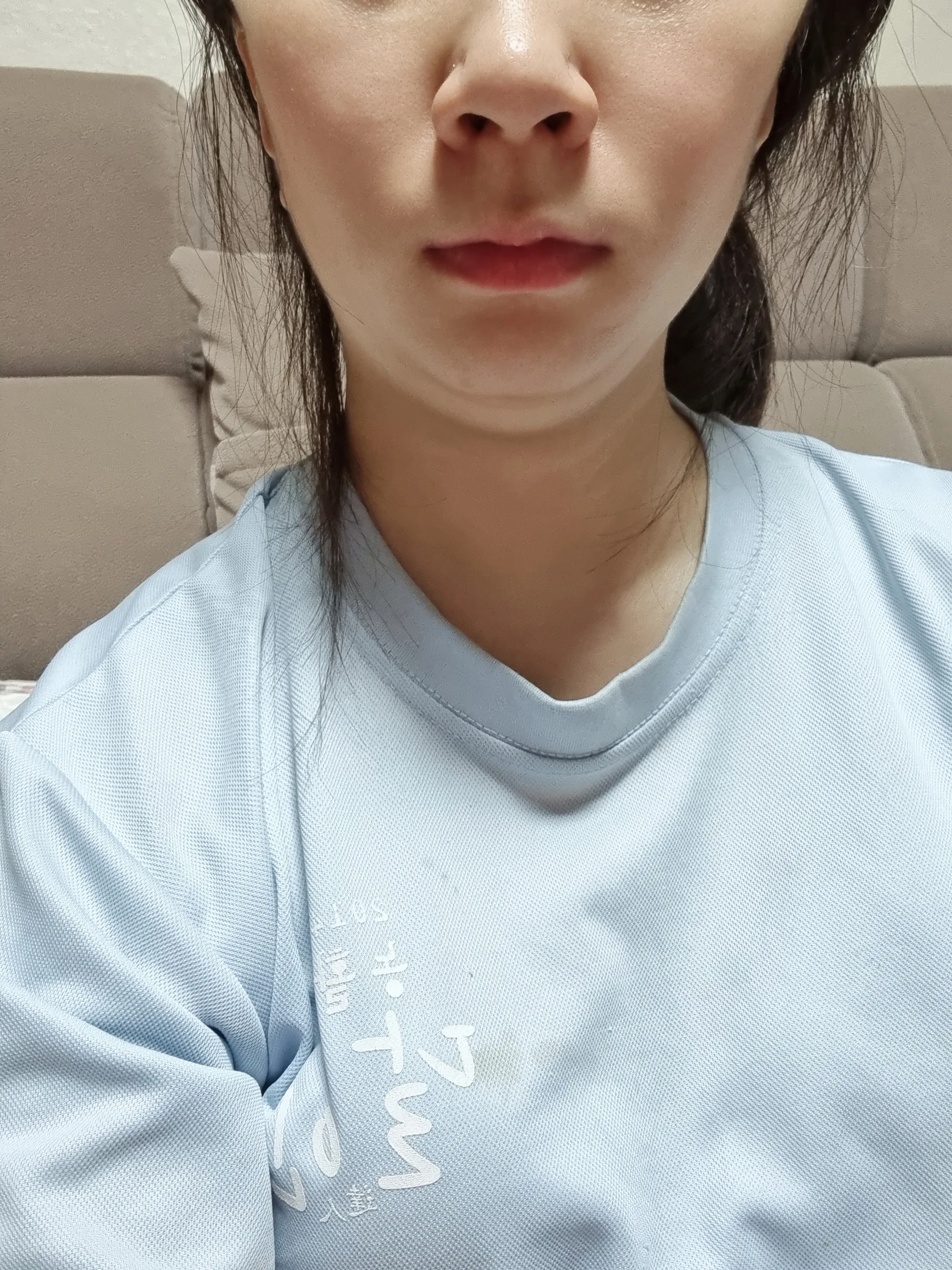 시술 후 — 미케이 피부 탄력개선_슈링크 300샷