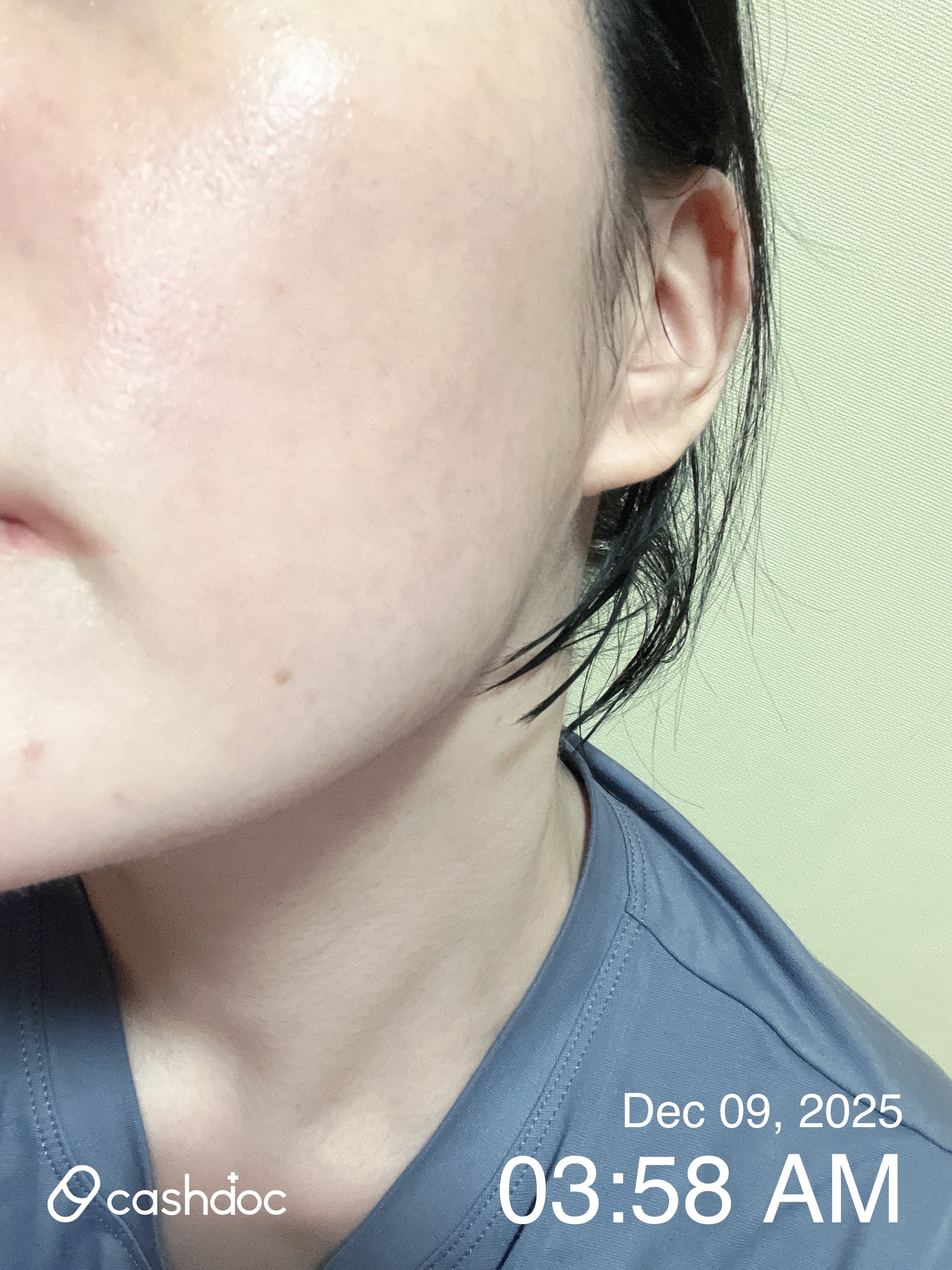 김포시에서 피부 건강을 지키는 곳, 아름다운오늘현경준피부과의원의 믿을 수 있는 진료 경험