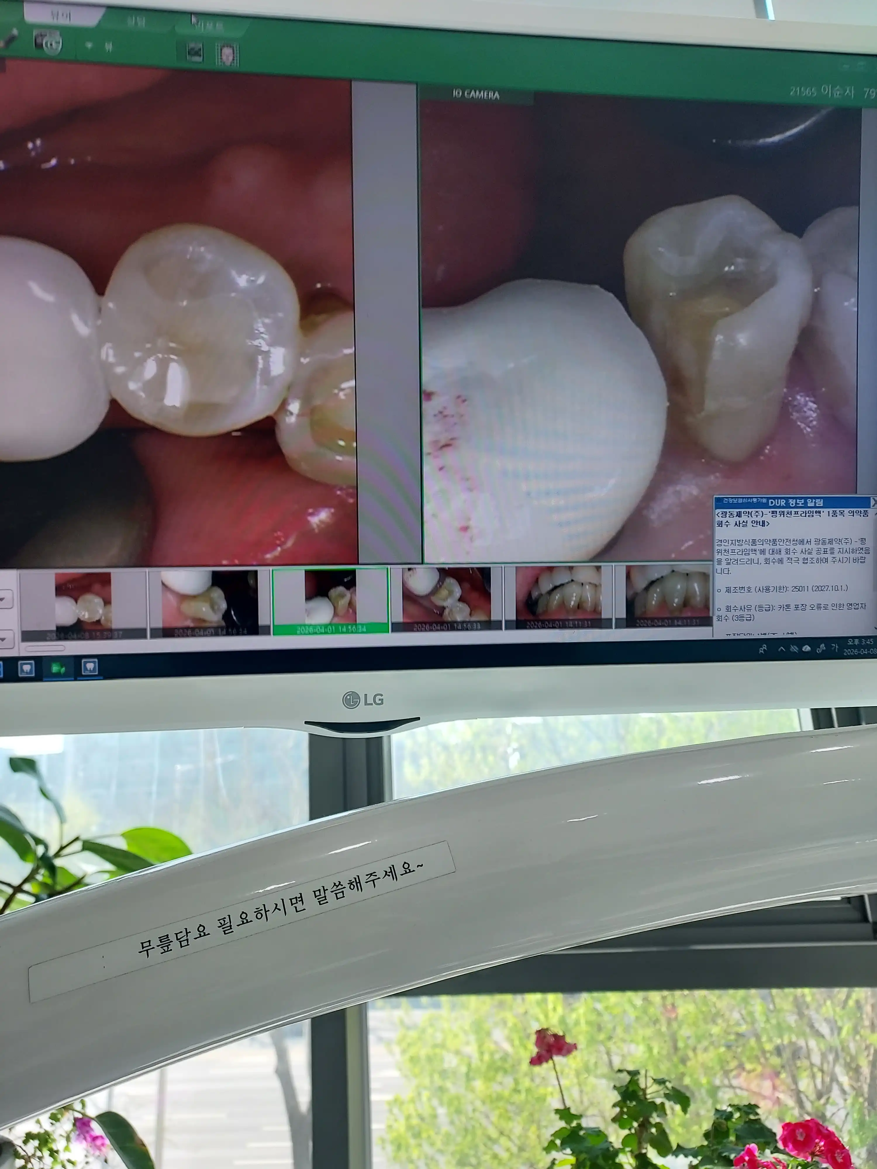 Review photo