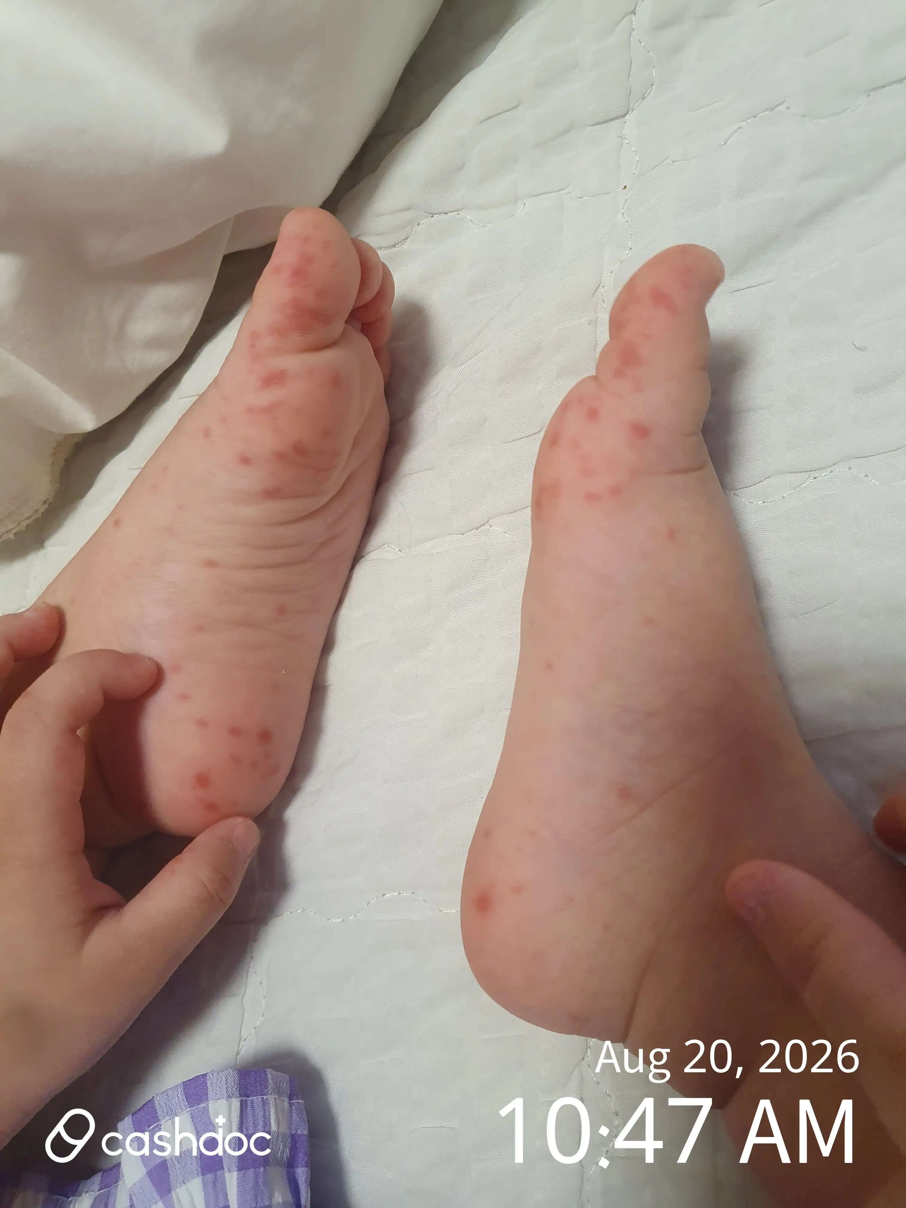 评价照片