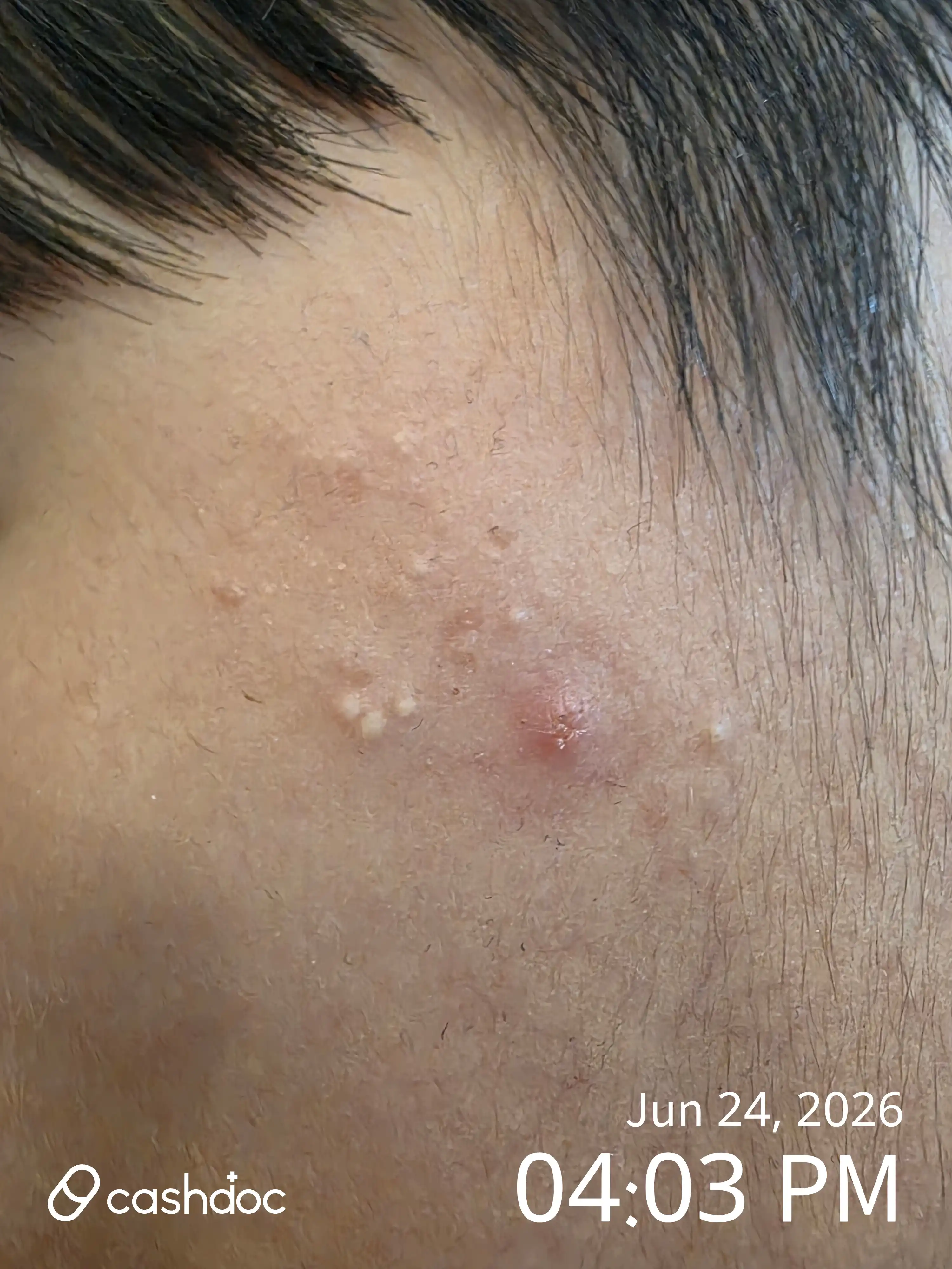 Review photo