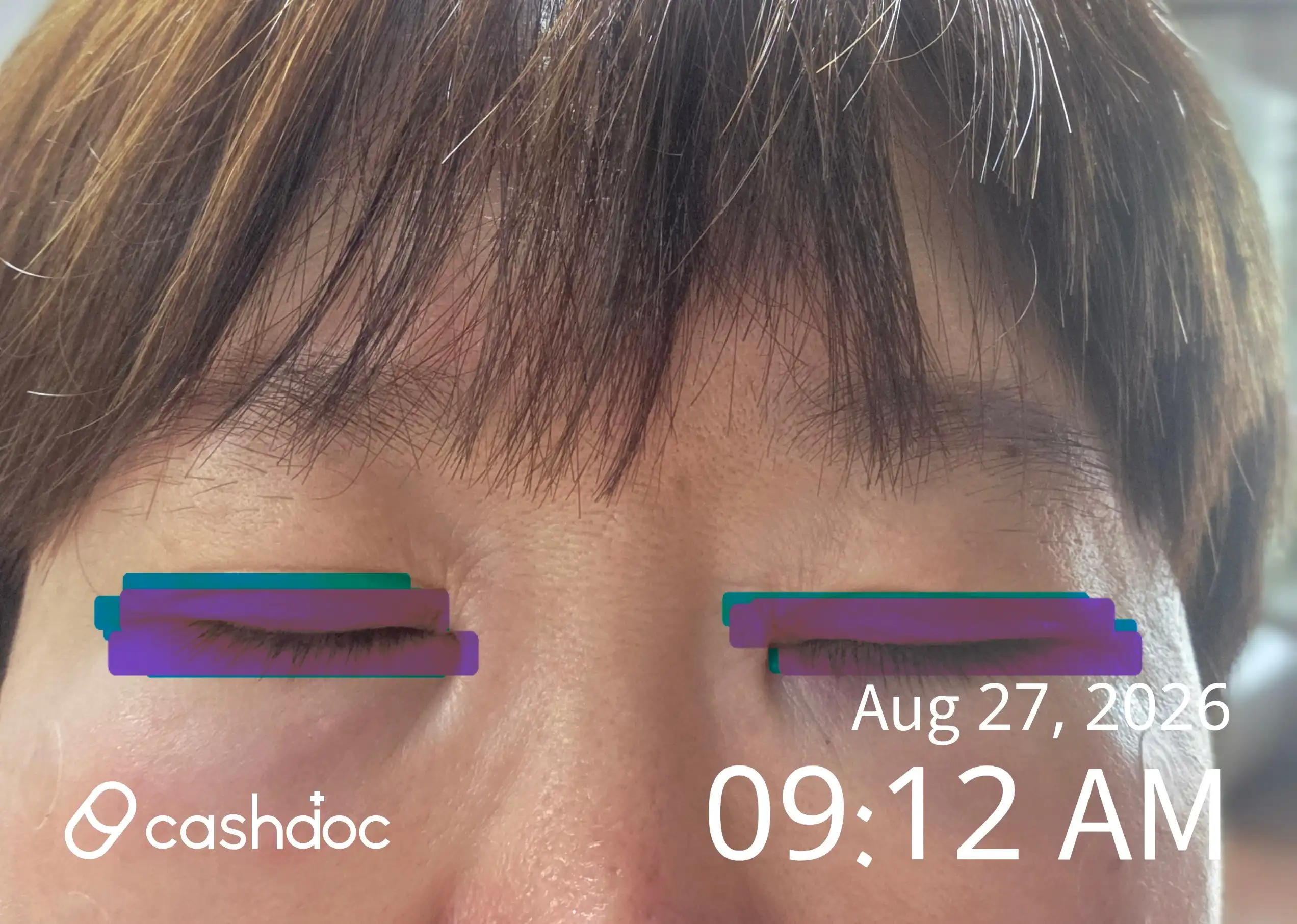 Review photo