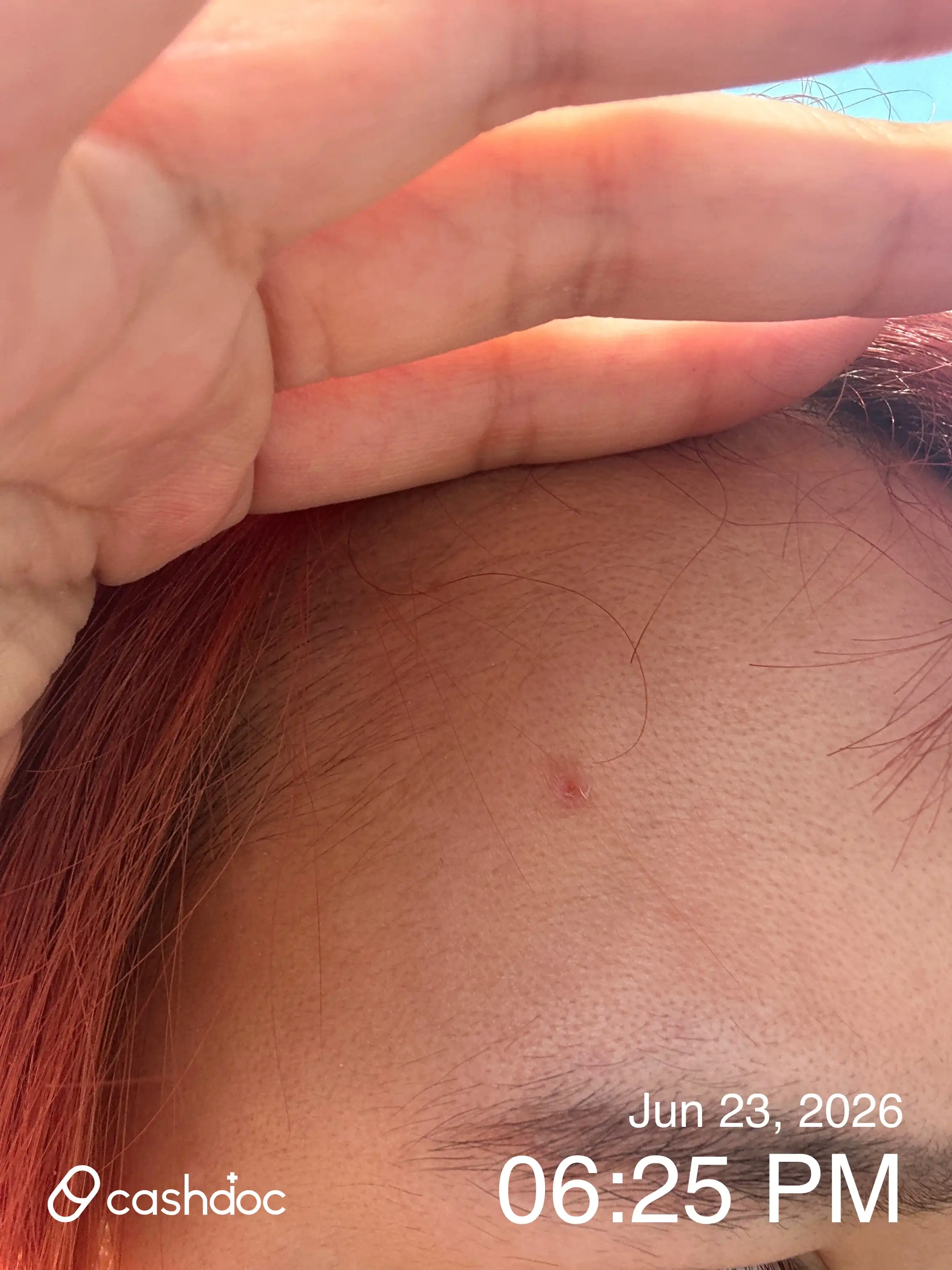 Review photo