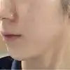 후