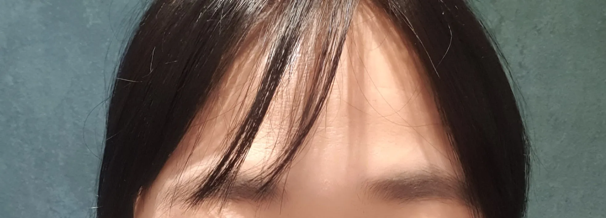 시술 전 — 안개그라눈썹 11만원