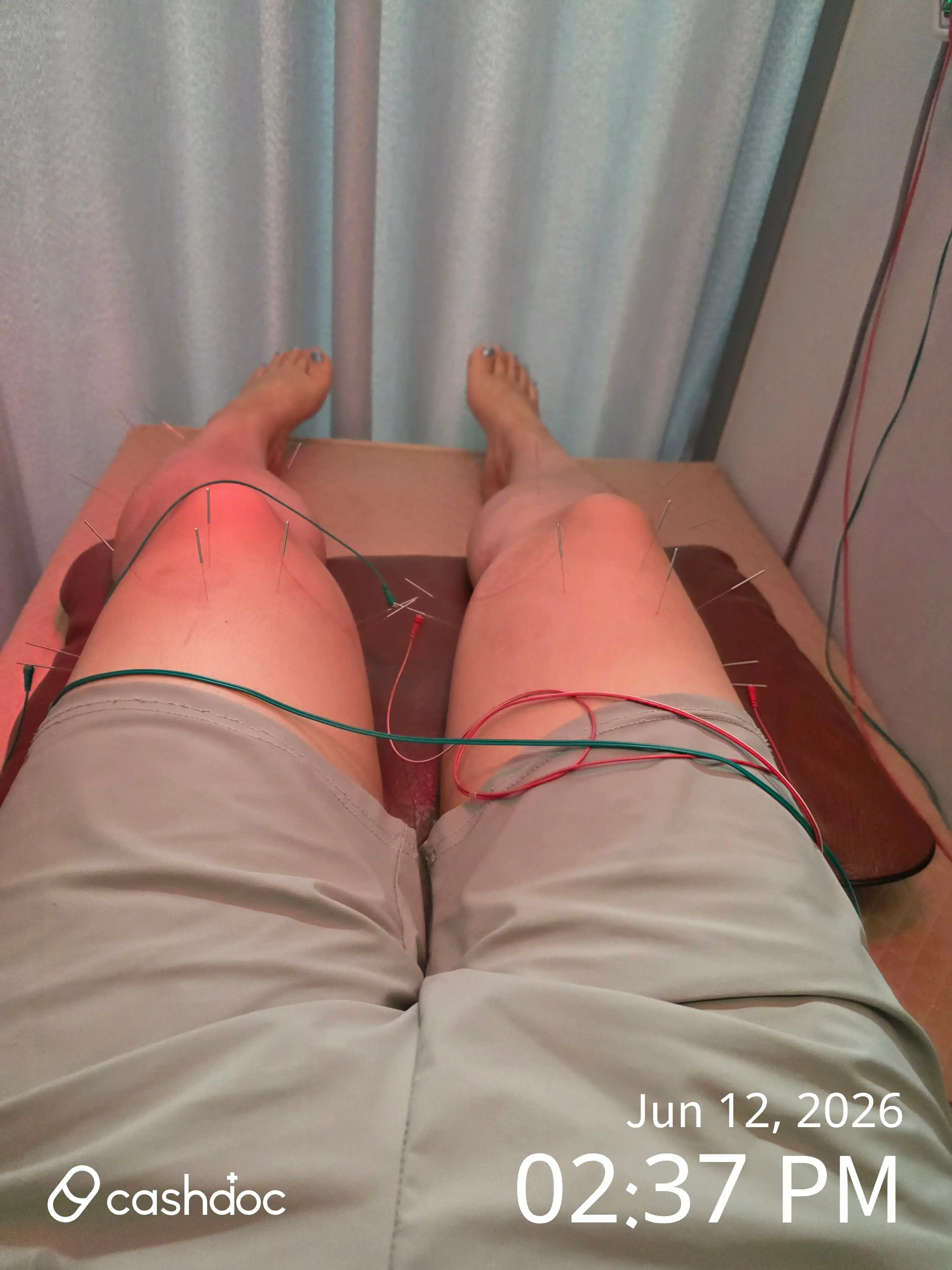 评价照片