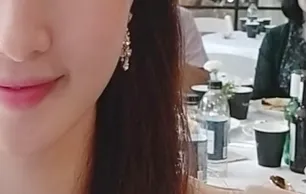 시술 후 — 인모드 리프팅