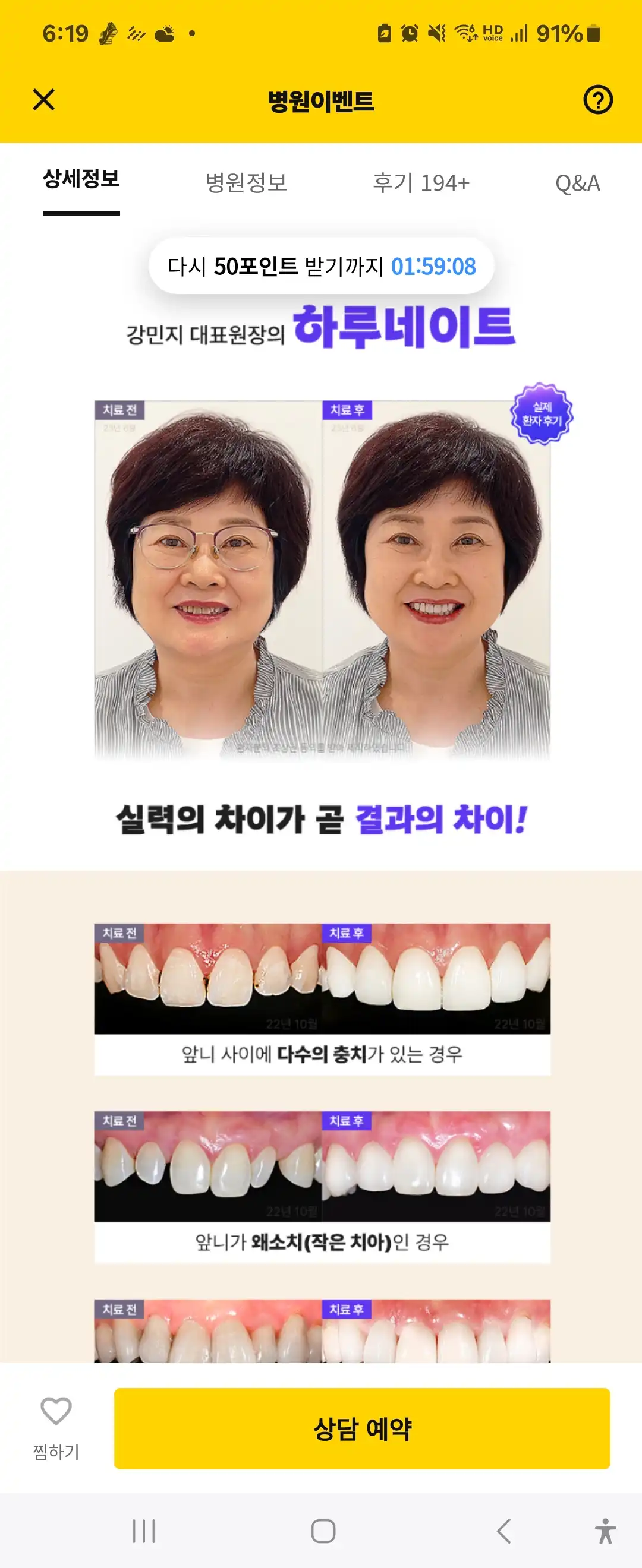 レビュー写真