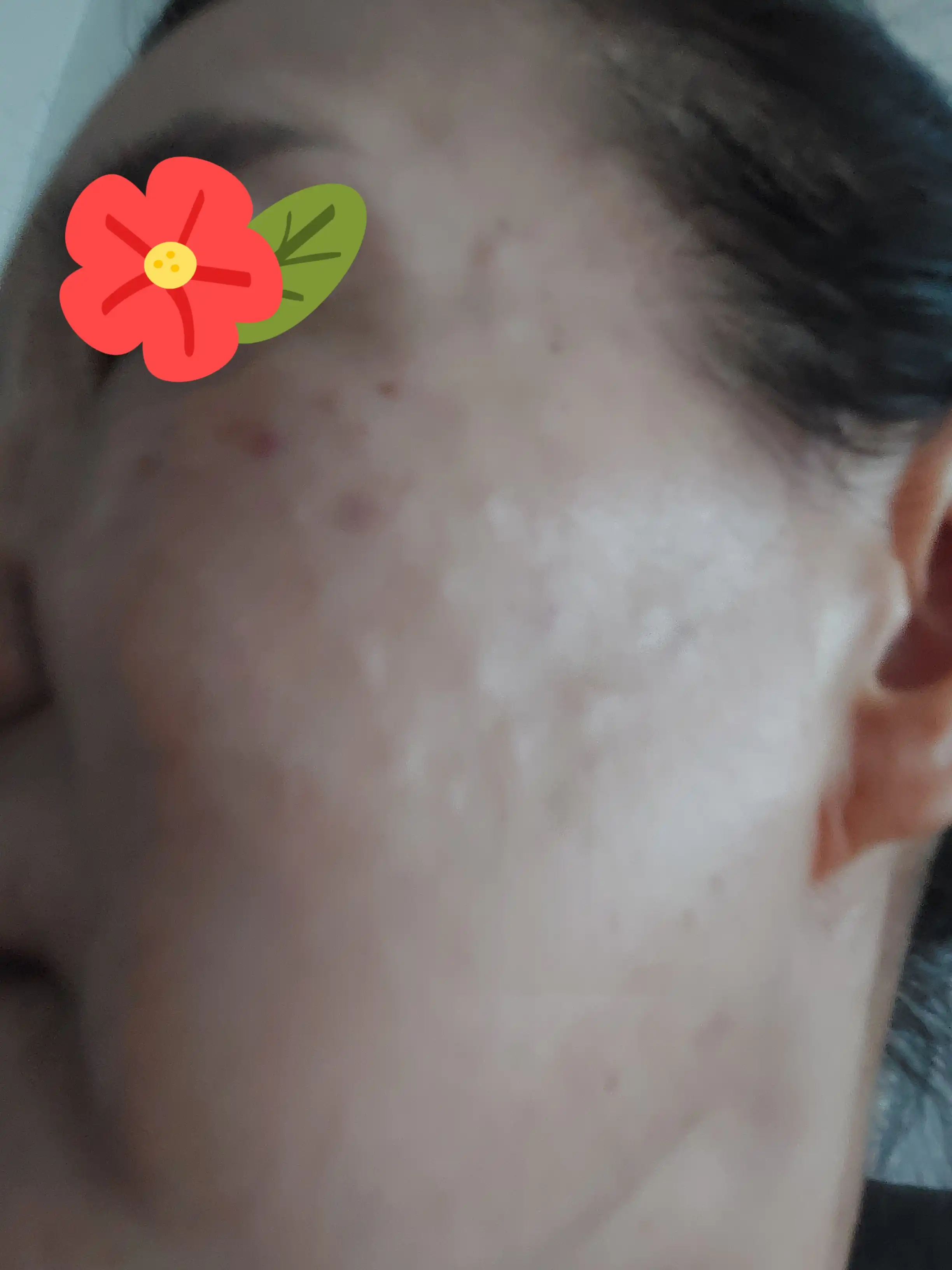 후
