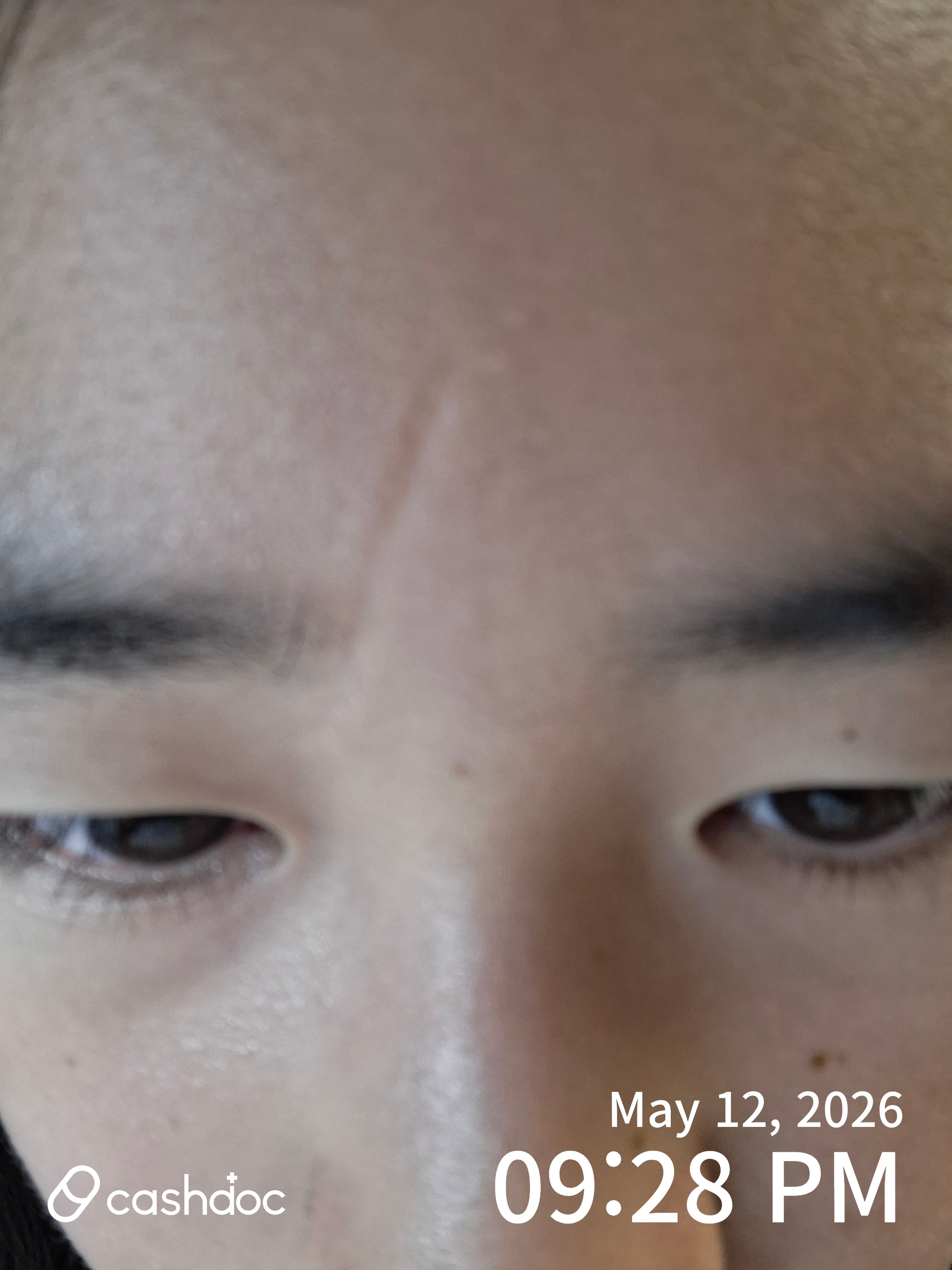 수원시 명성형외과의원, 아픈 기억이 포근하게 변한 곳