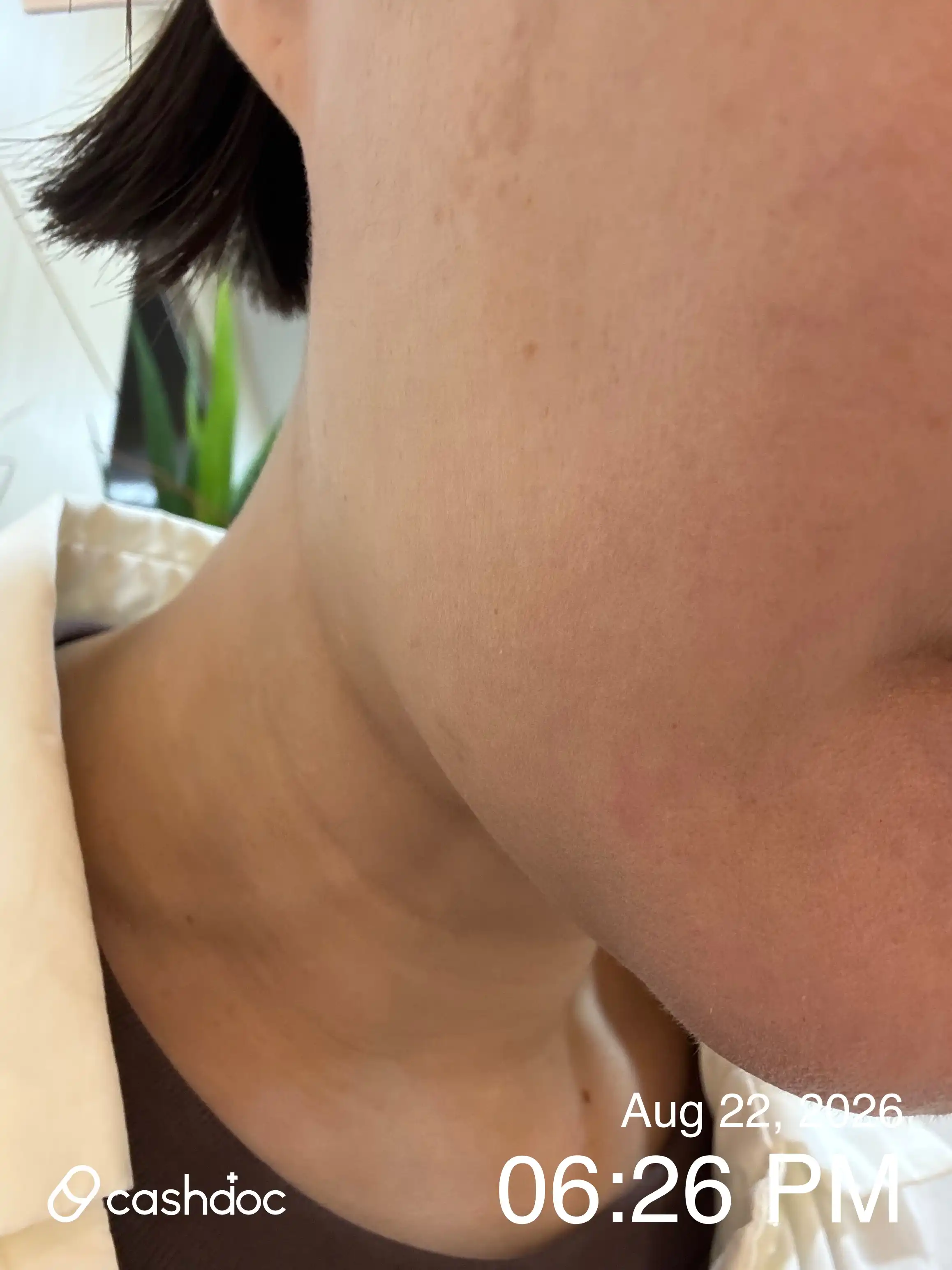 评价照片