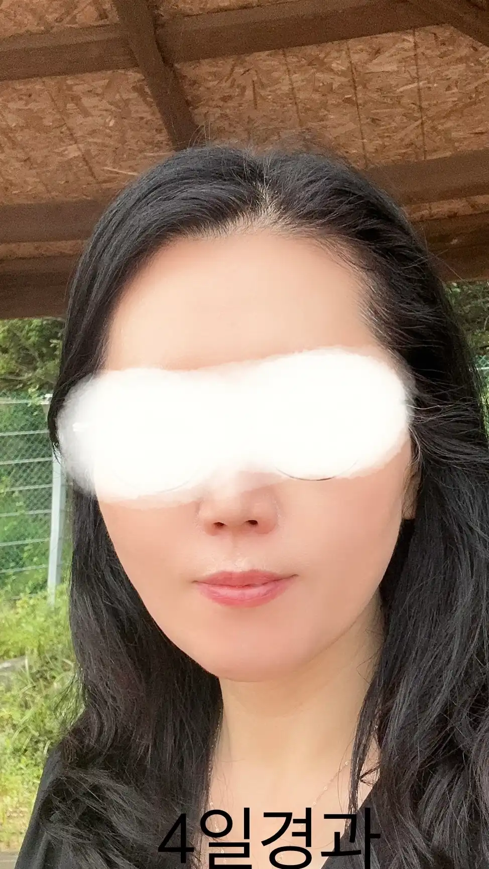 후