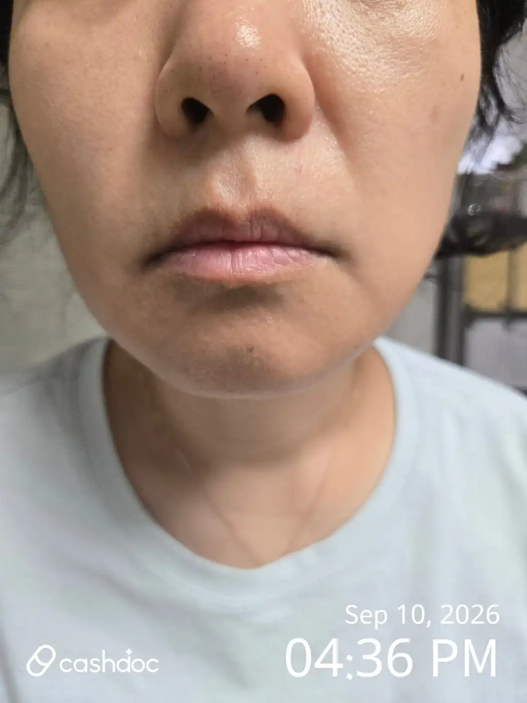 评价照片